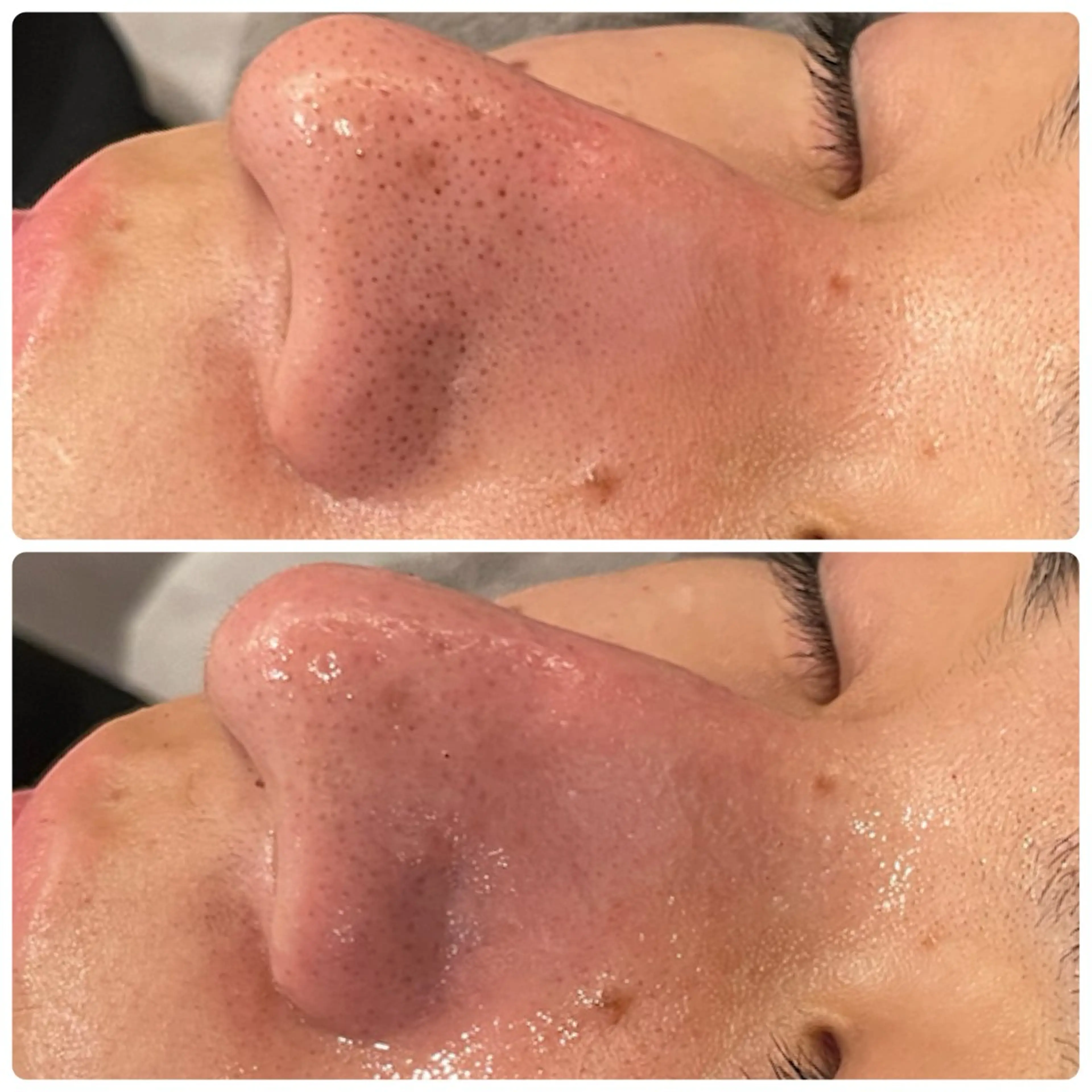 脱毛 yellow.所属・yellow💛【 脱毛&フェイシャル】のエステ・リラクイメージ