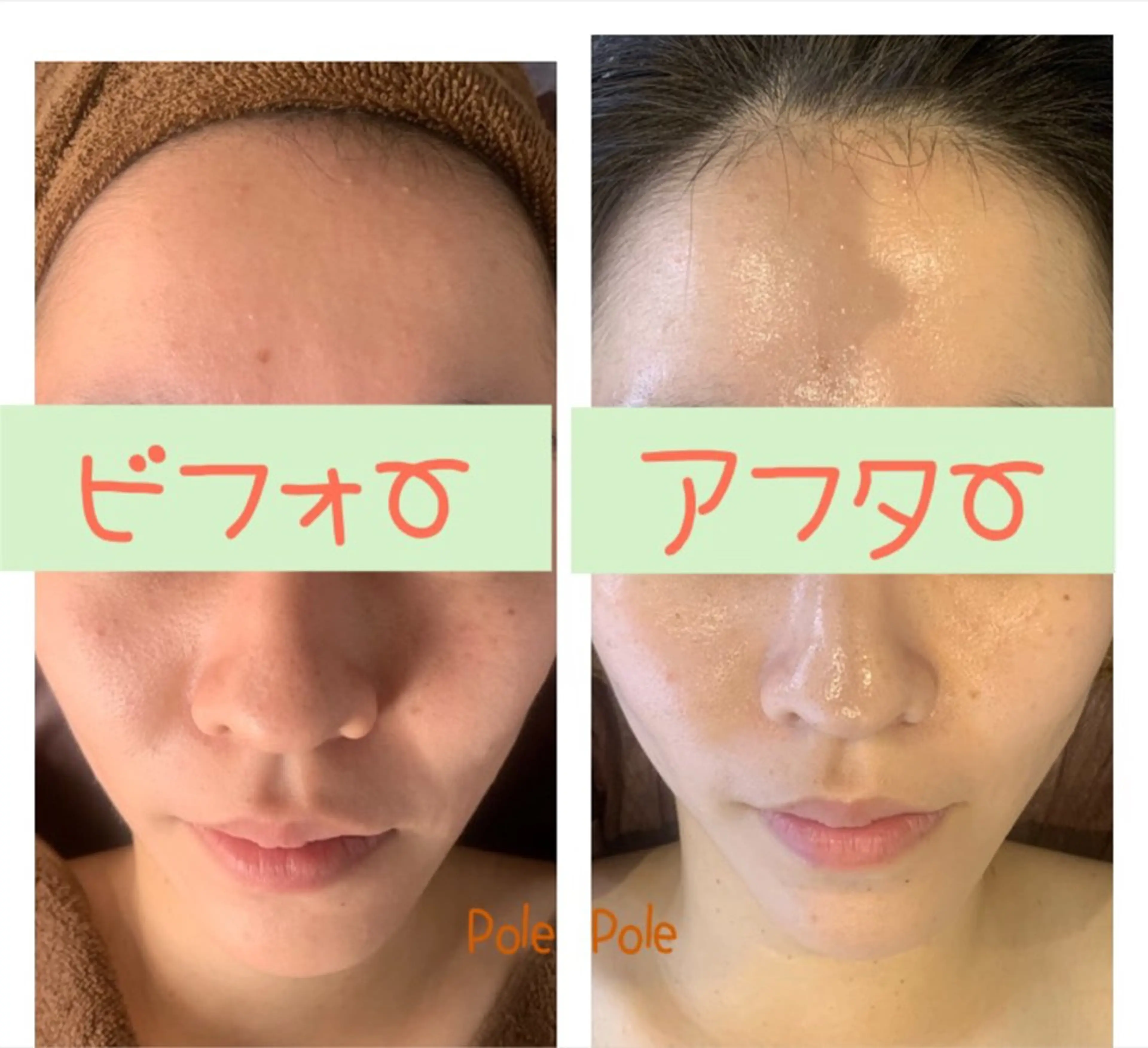 極上コース（フェイシャル）の写真