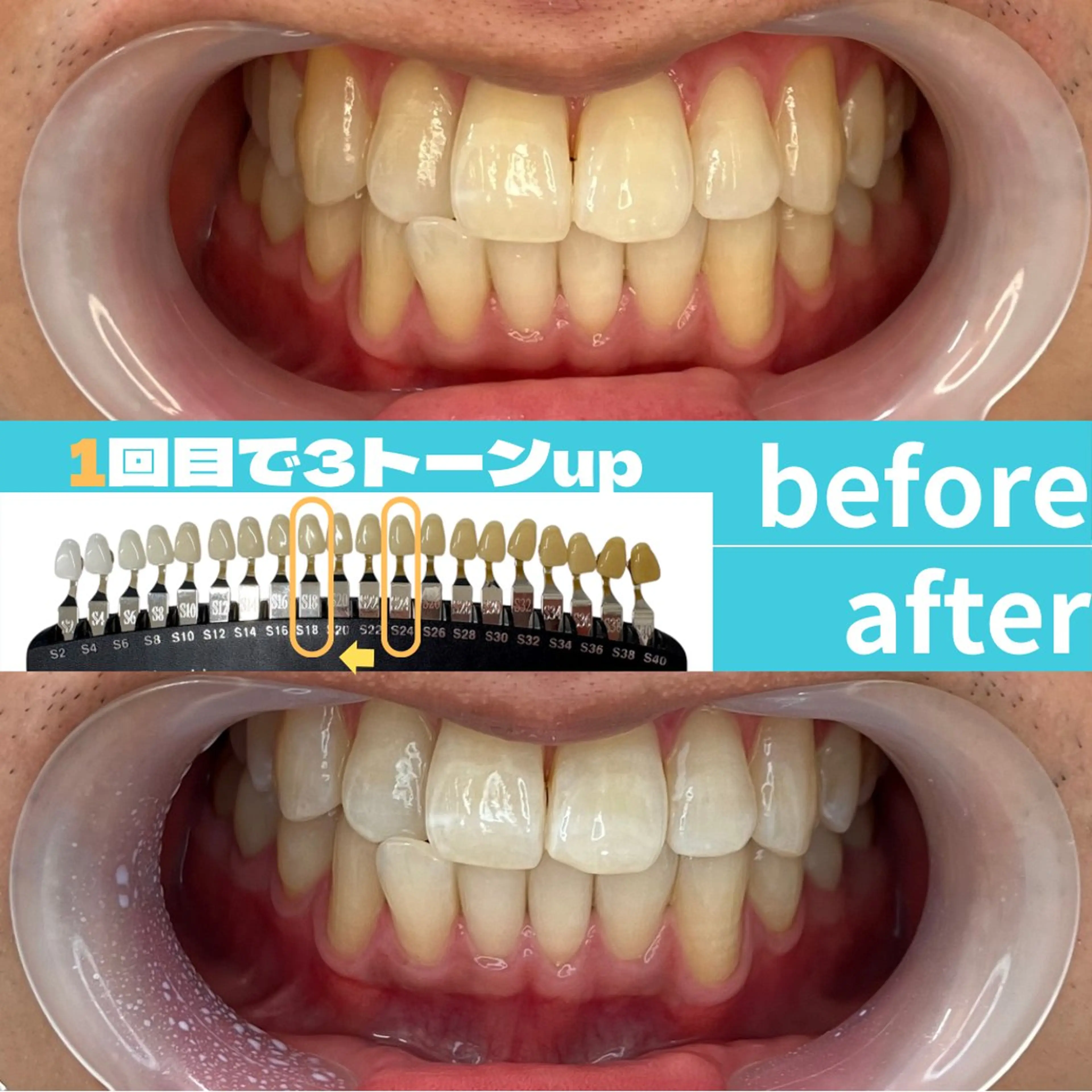 エステ s rikoのエステ・リラクイメージ