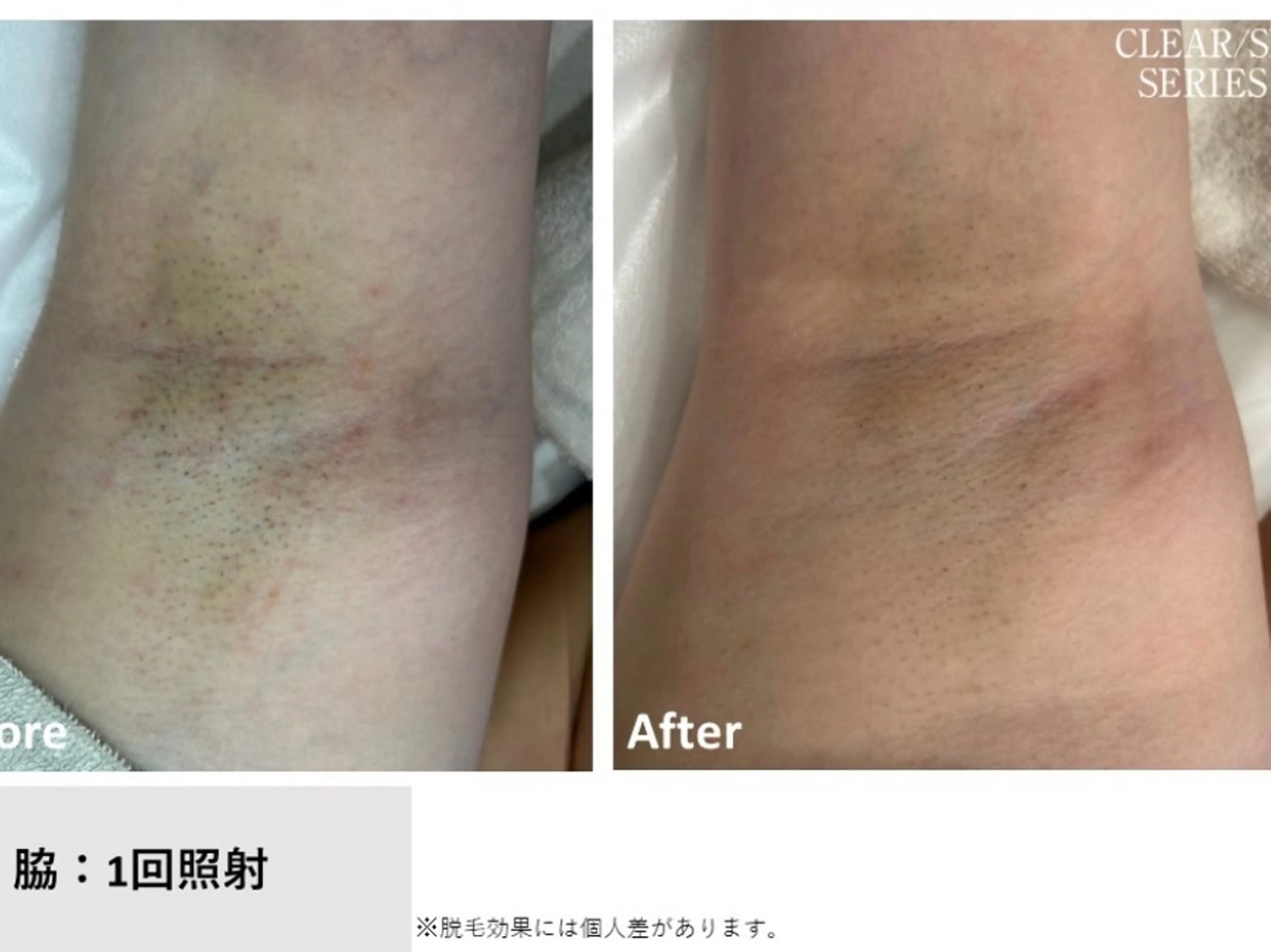 脱毛サロン ニカ所属・☀️脱毛・美容矯正 サロン ニカ☀️のエステ・リラクイメージ