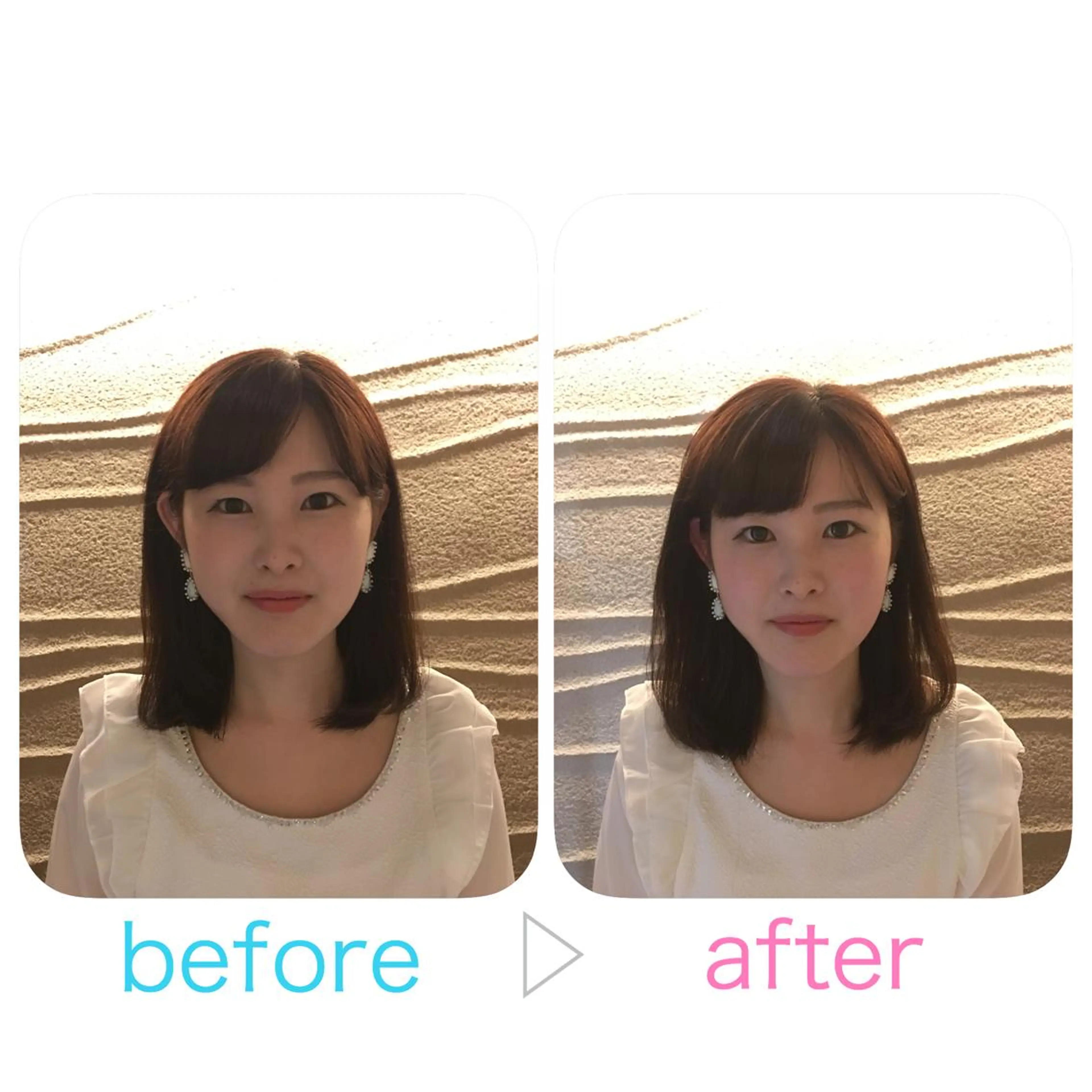 美容鍼とルート治療 iRu 金沢所属・中田 達也のその他イメージ