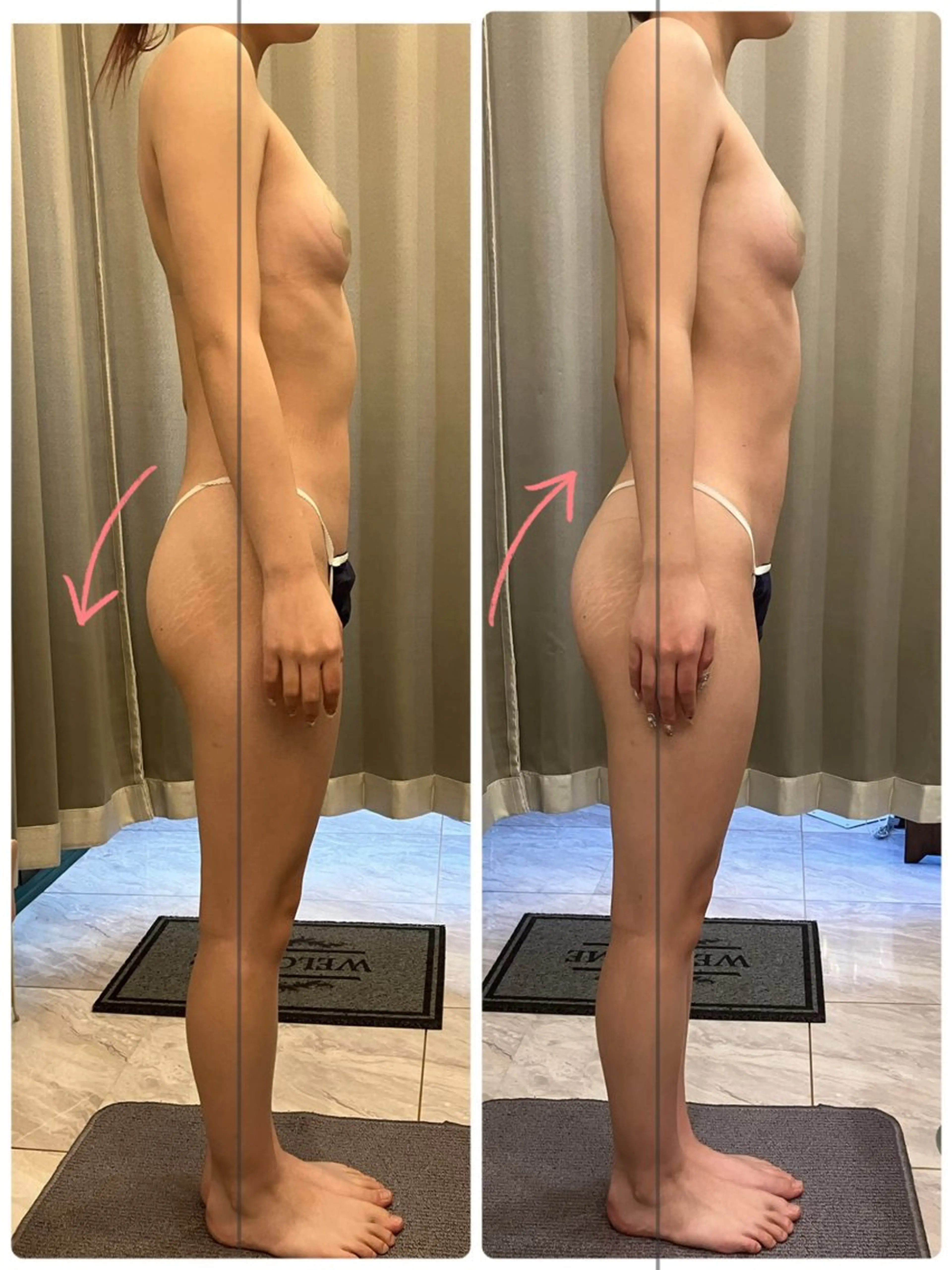 エステ リラク infinity所属・Infinity インフィニティのその他イメージ