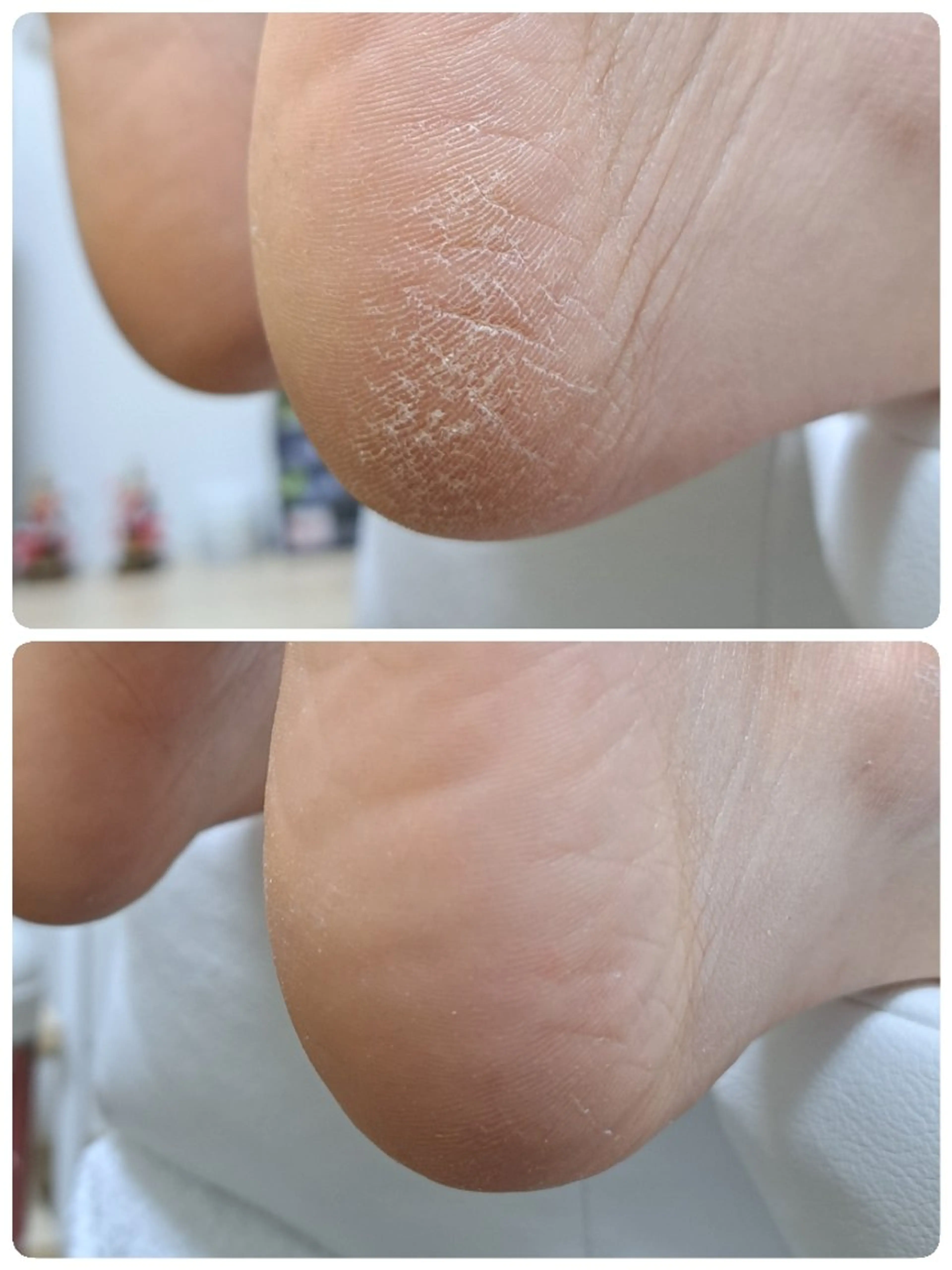 その他(ネイル) B-BAUM  nailsalon のネイルデザイン