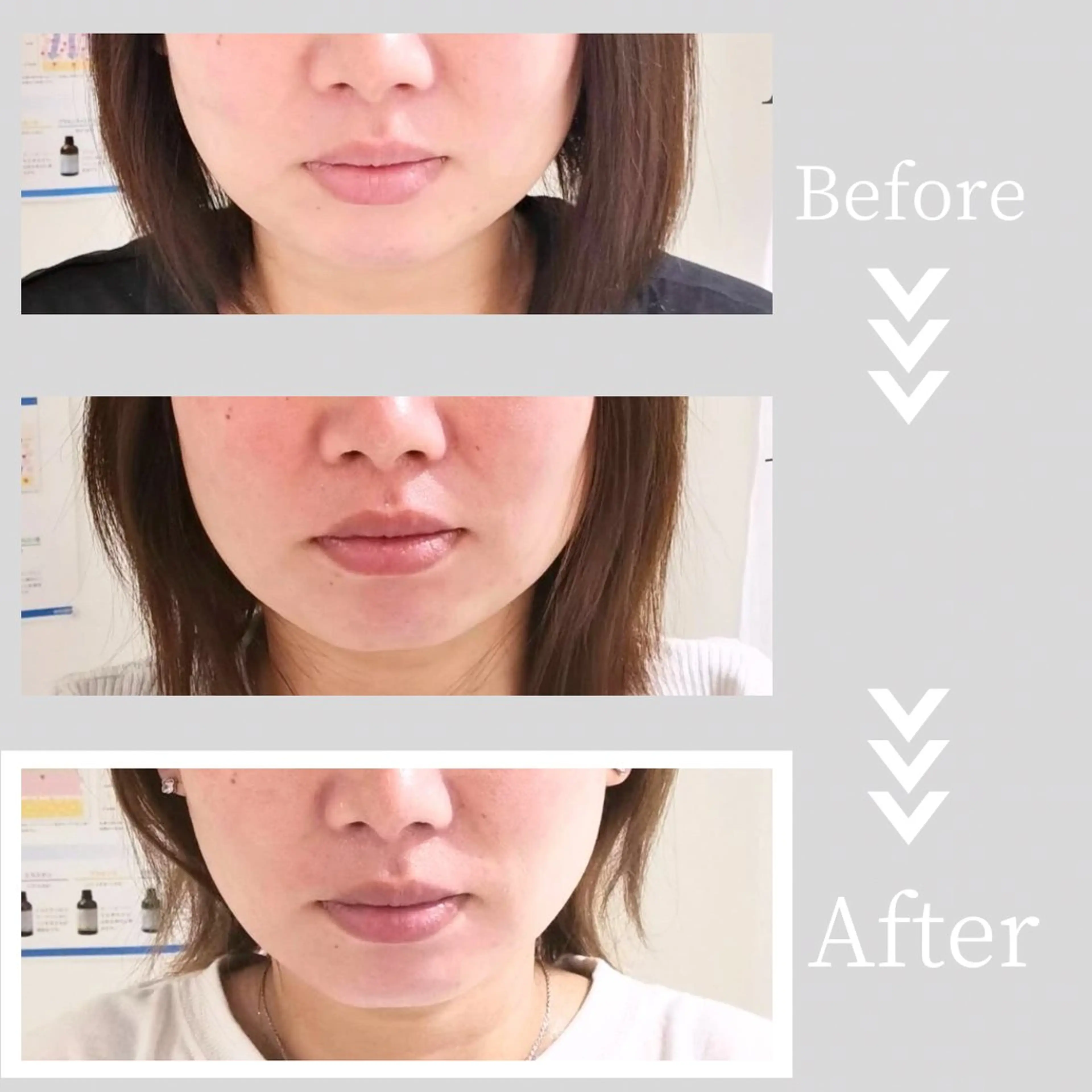 小顔・ツルツル素肌 ハリステリアのエステ・リラクイメージ