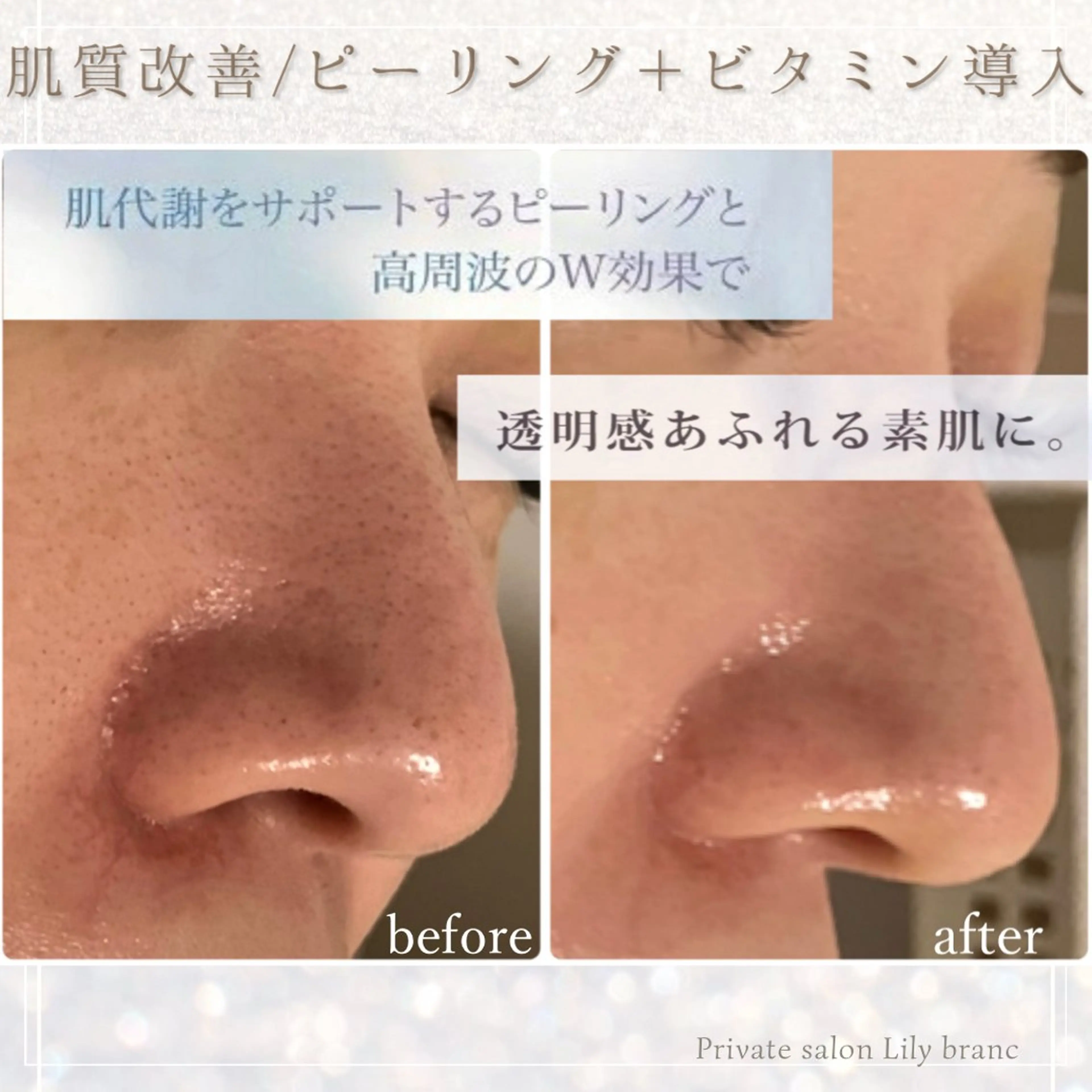 Lily branc 痩身/小顔/肌質改善のエステ・リラクイメージ