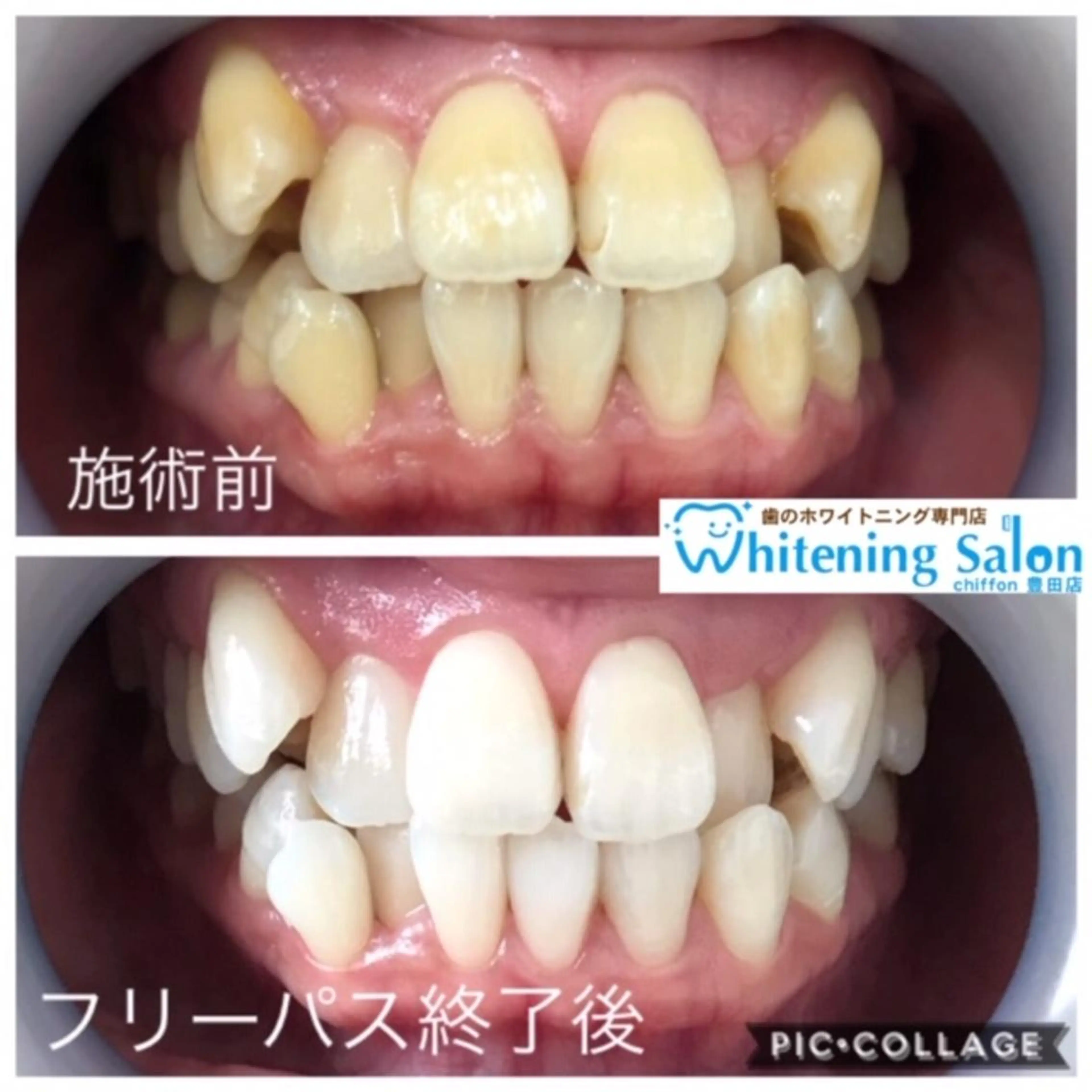 歯科レベルの白さ💎 ✨ホワイトニング豊田のエステ・リラクイメージ