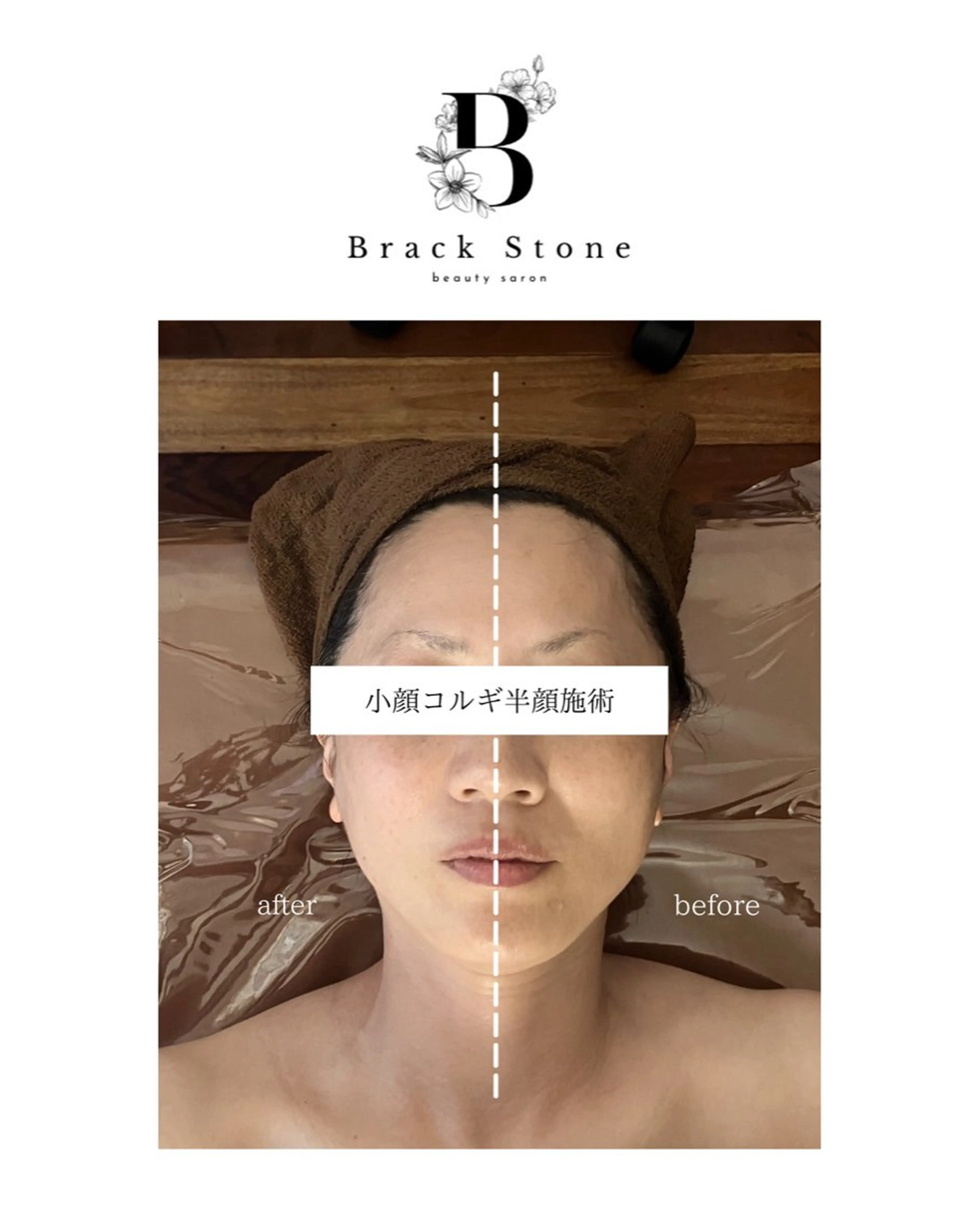 Black Stone所属・Black Stoneのエステ・リラクイメージ