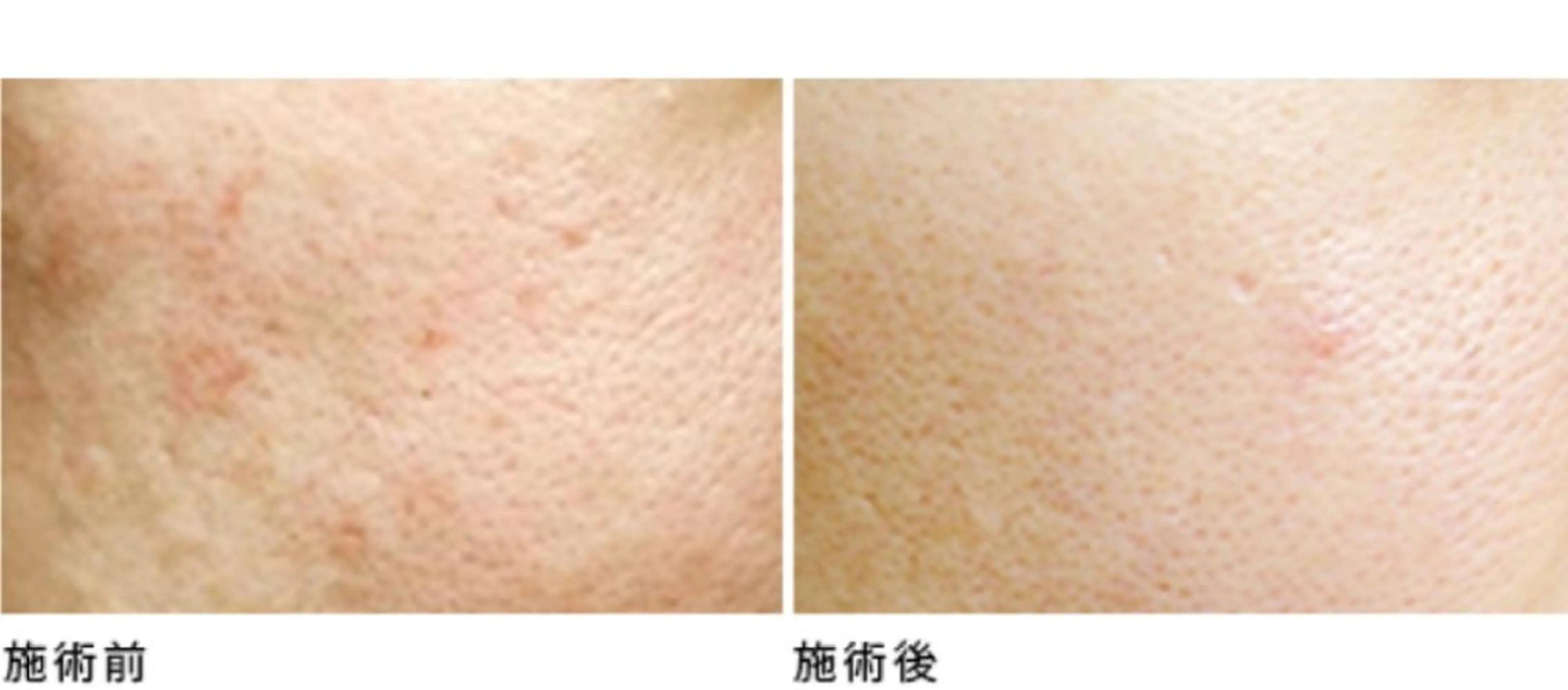 Non ビューティサロンのエステ・リラクイメージ