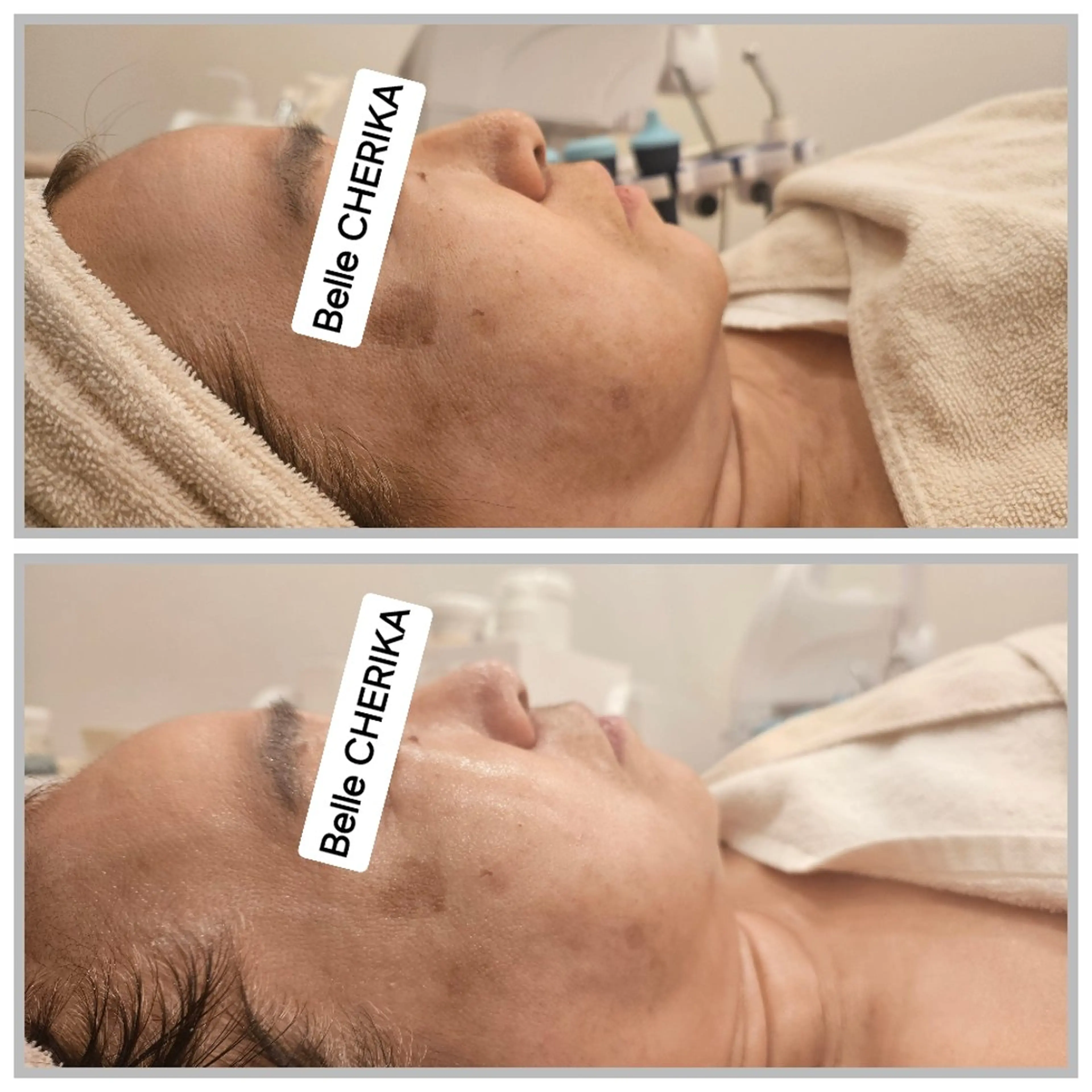 エステ ベル チェリカ 三城のエステ・リラクイメージ