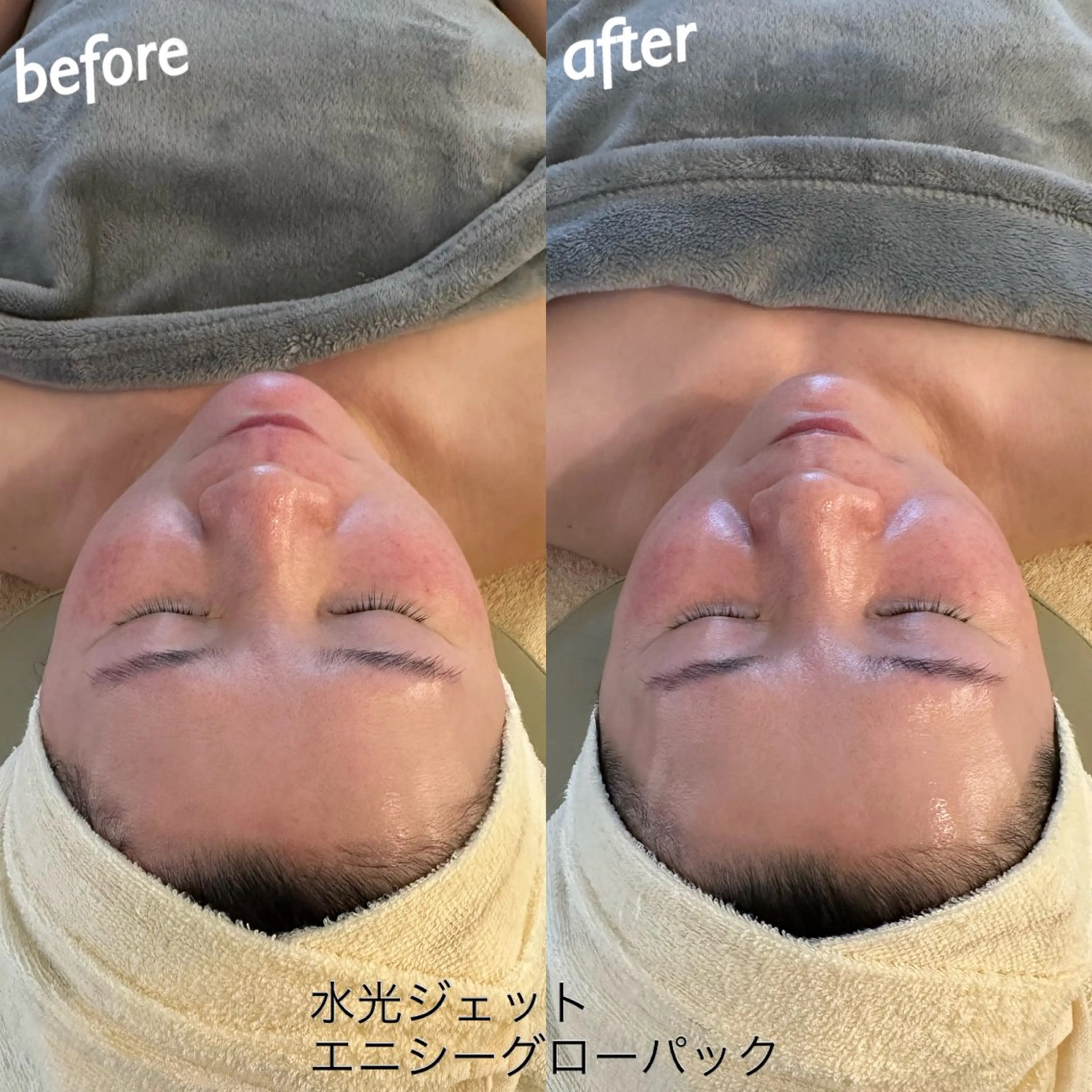 エステ うなじ脱毛/美肌脱毛 LABELのエステ・リラクイメージ