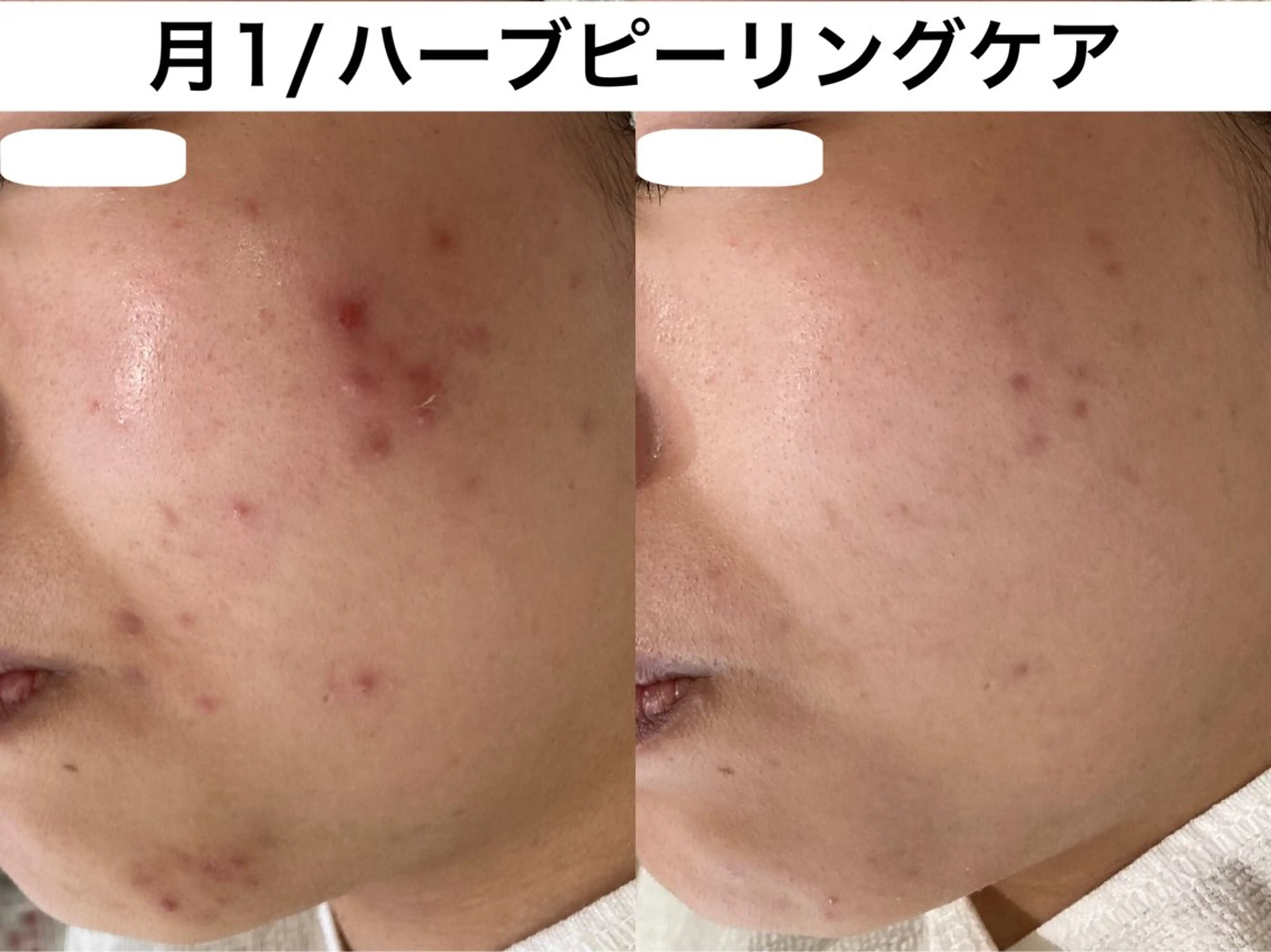 TRINIENCE 南流山店のエステ・リラクイメージ