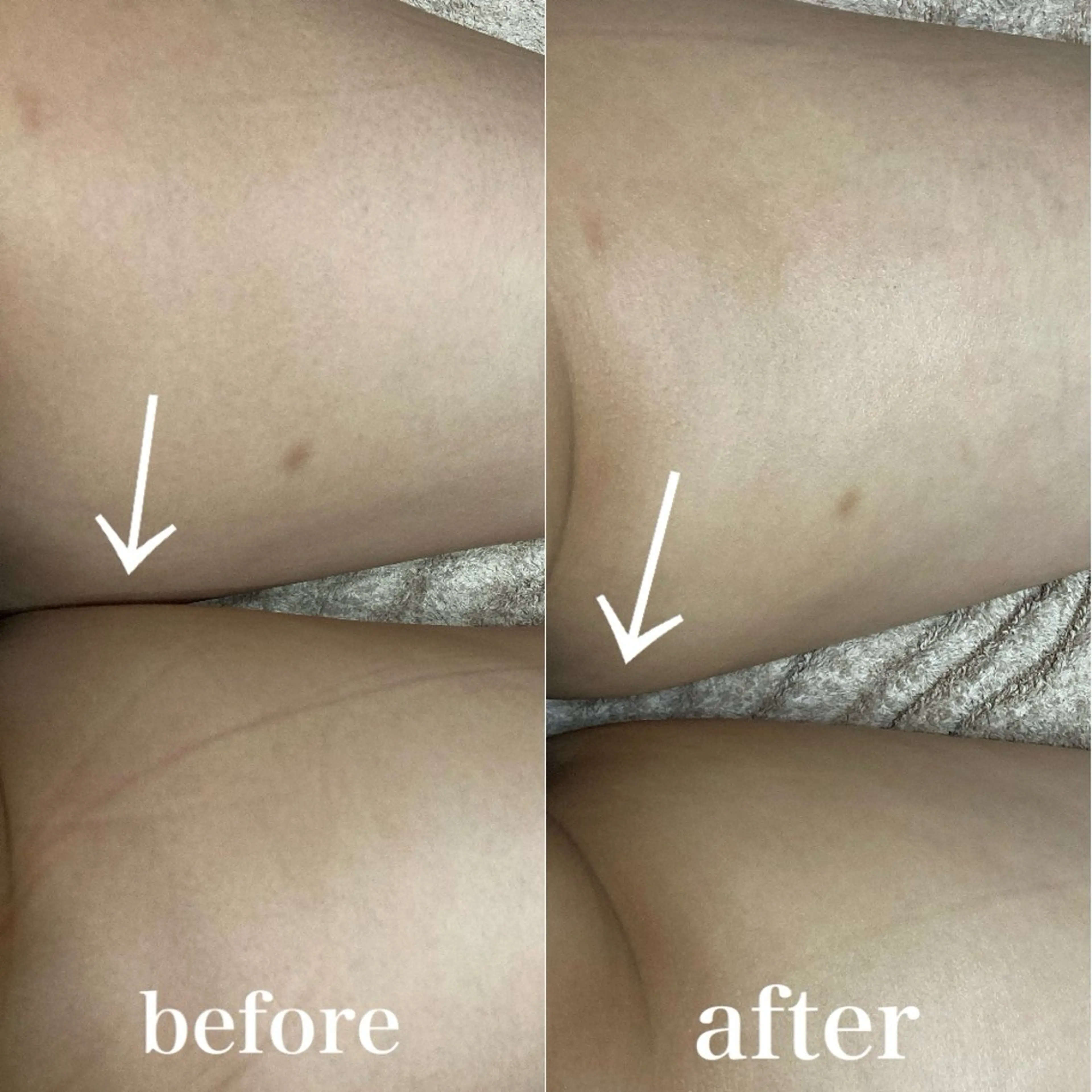 磐田｜LAYLA 一番丁寧な脱毛店のエステ・リラクイメージ