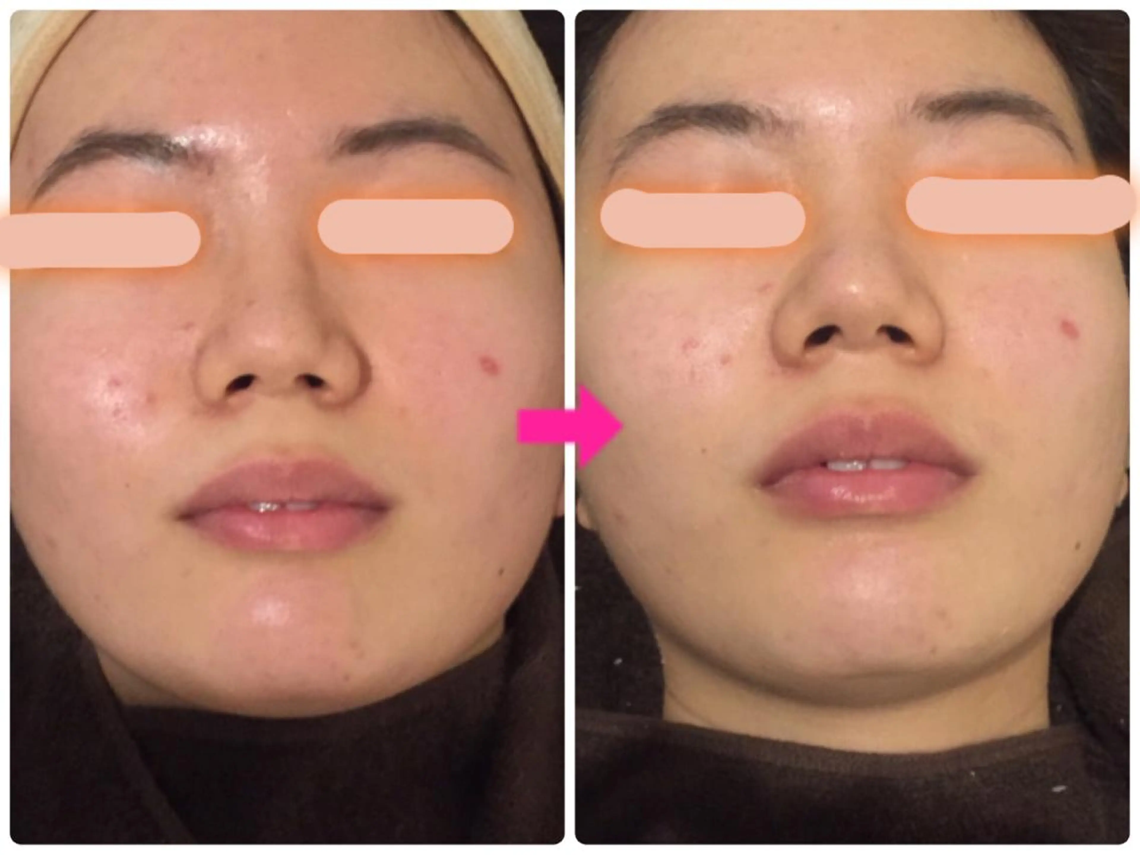 ロング カラー パーマ ヘアアレンジ メンズ キッズ ネイル マツエク・マツパ ‍痩身＆ボディ 結果出し🌟丹野のエステ・リラクイメージ