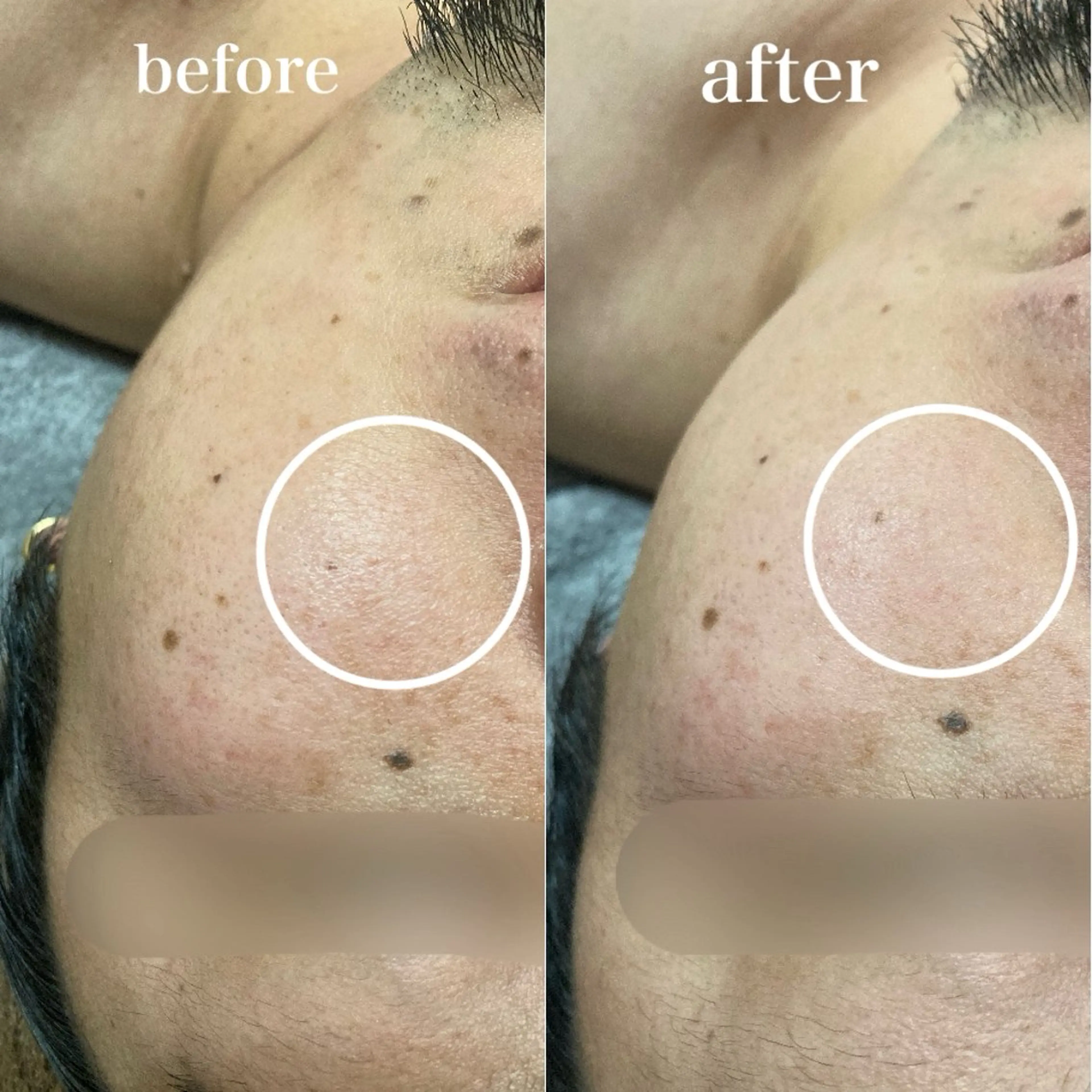 磐田｜LAYLA 一番丁寧な脱毛店のエステ・リラクイメージ