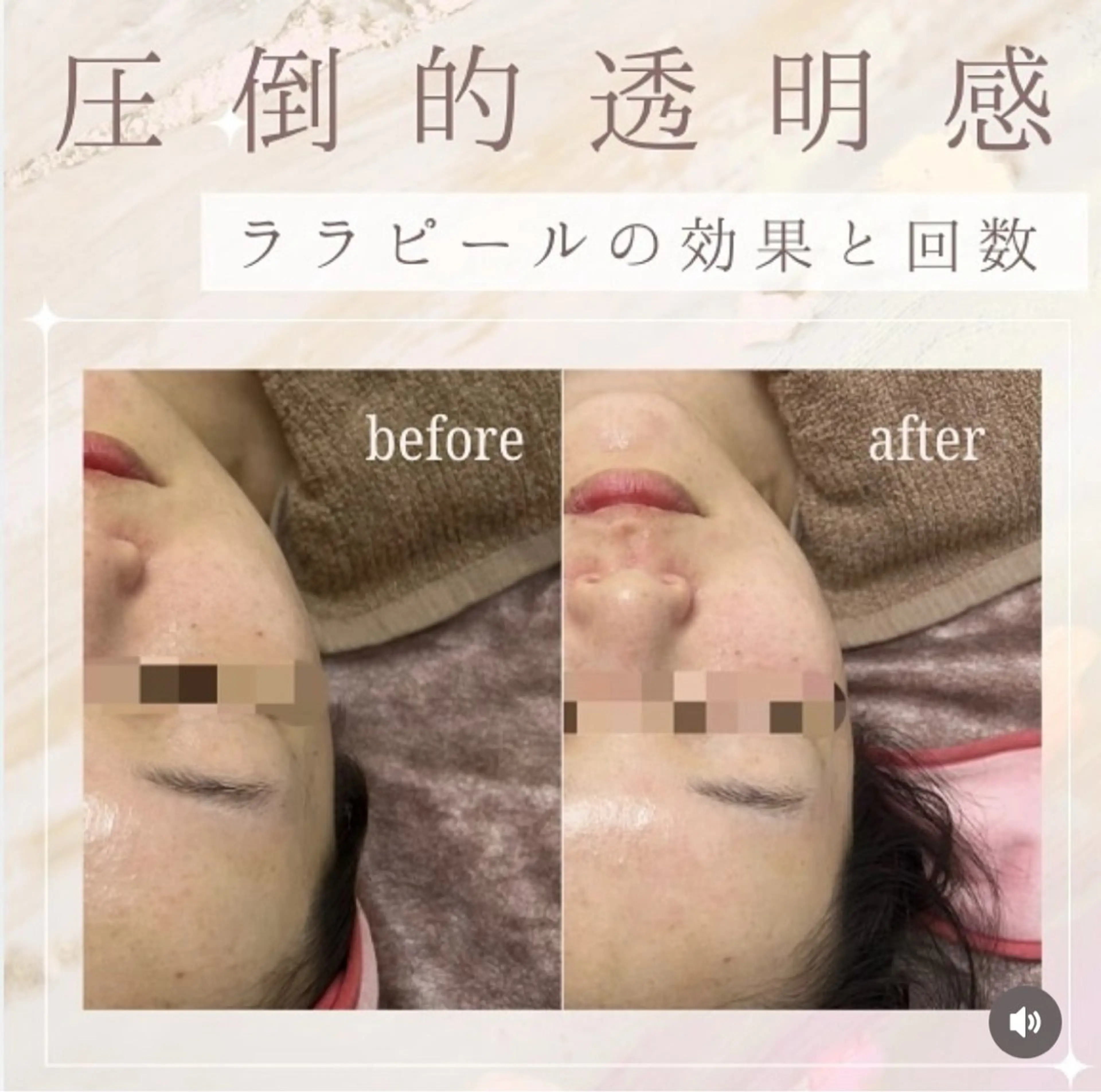 エステ 看護師が施術する ナスサロ/Emi🪽のエステ・リラクイメージ