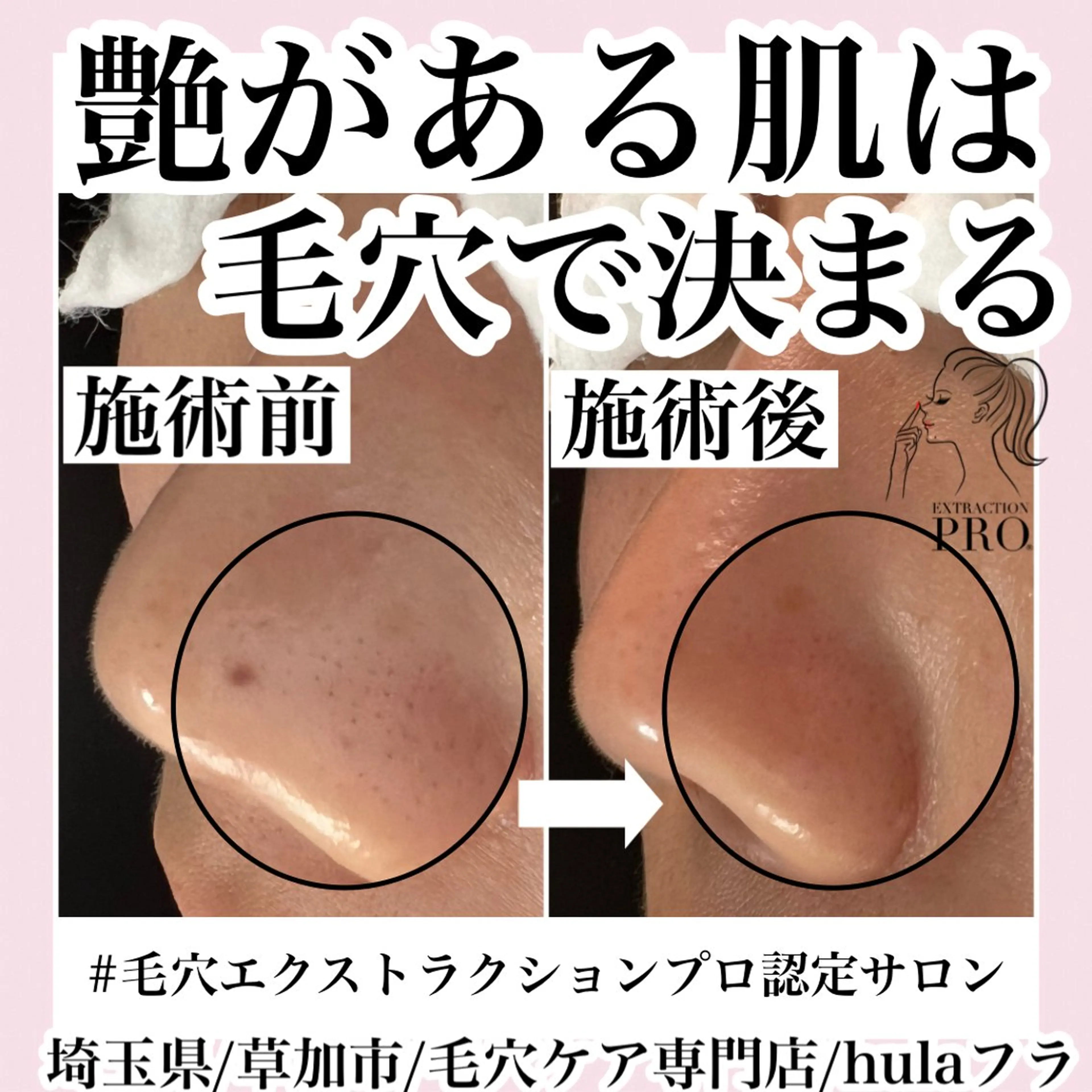 エステ 毛穴専門店hula 杉山智美のエステ・リラクイメージ