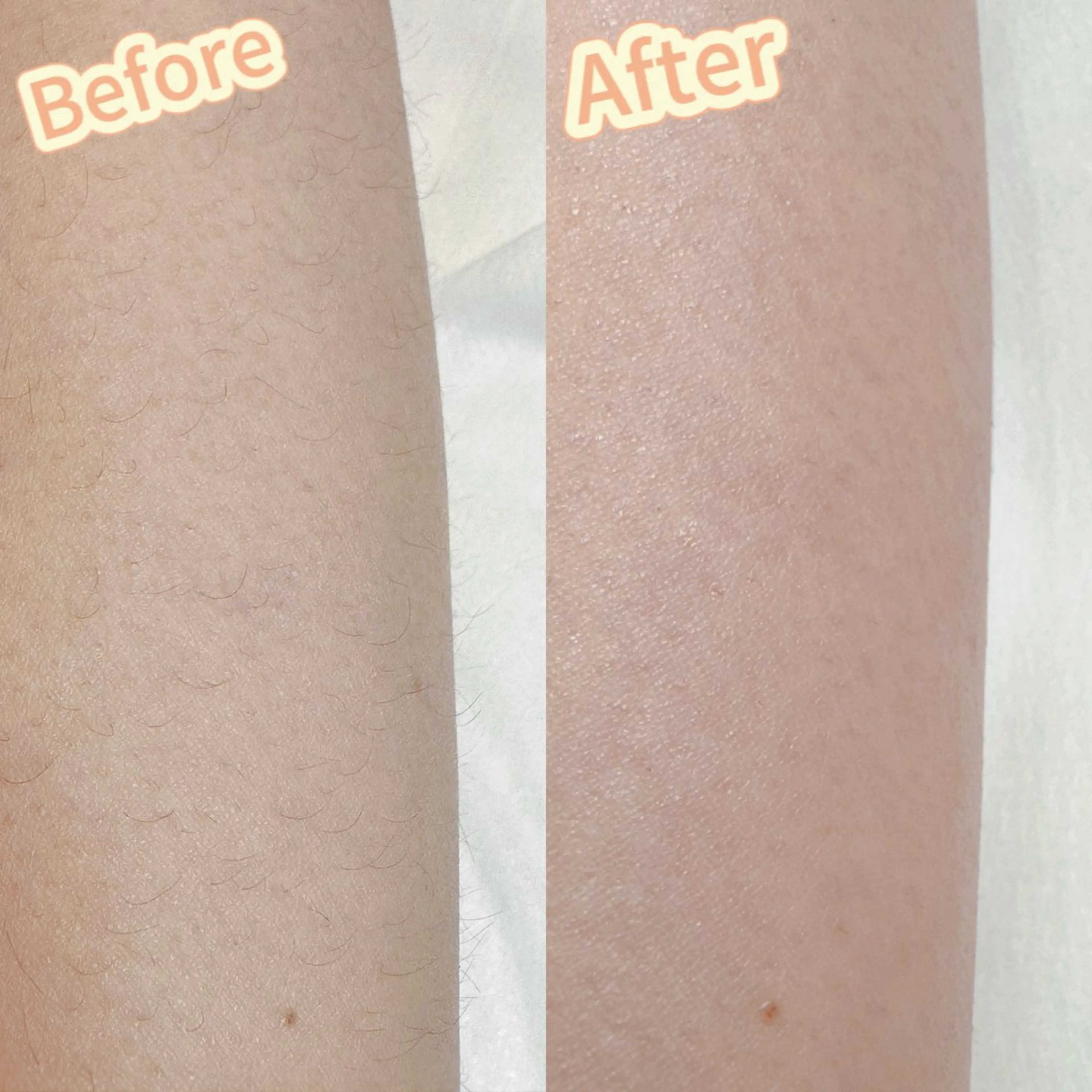 Hit. シュガーリング豊橋のエステ・リラクイメージ