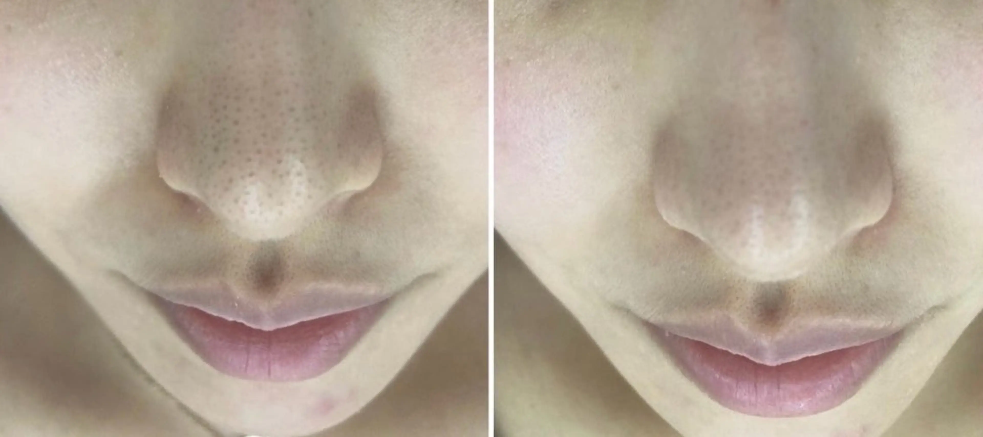 メンズ エステ 美Face所属・美 Faceのエステ・リラクイメージ