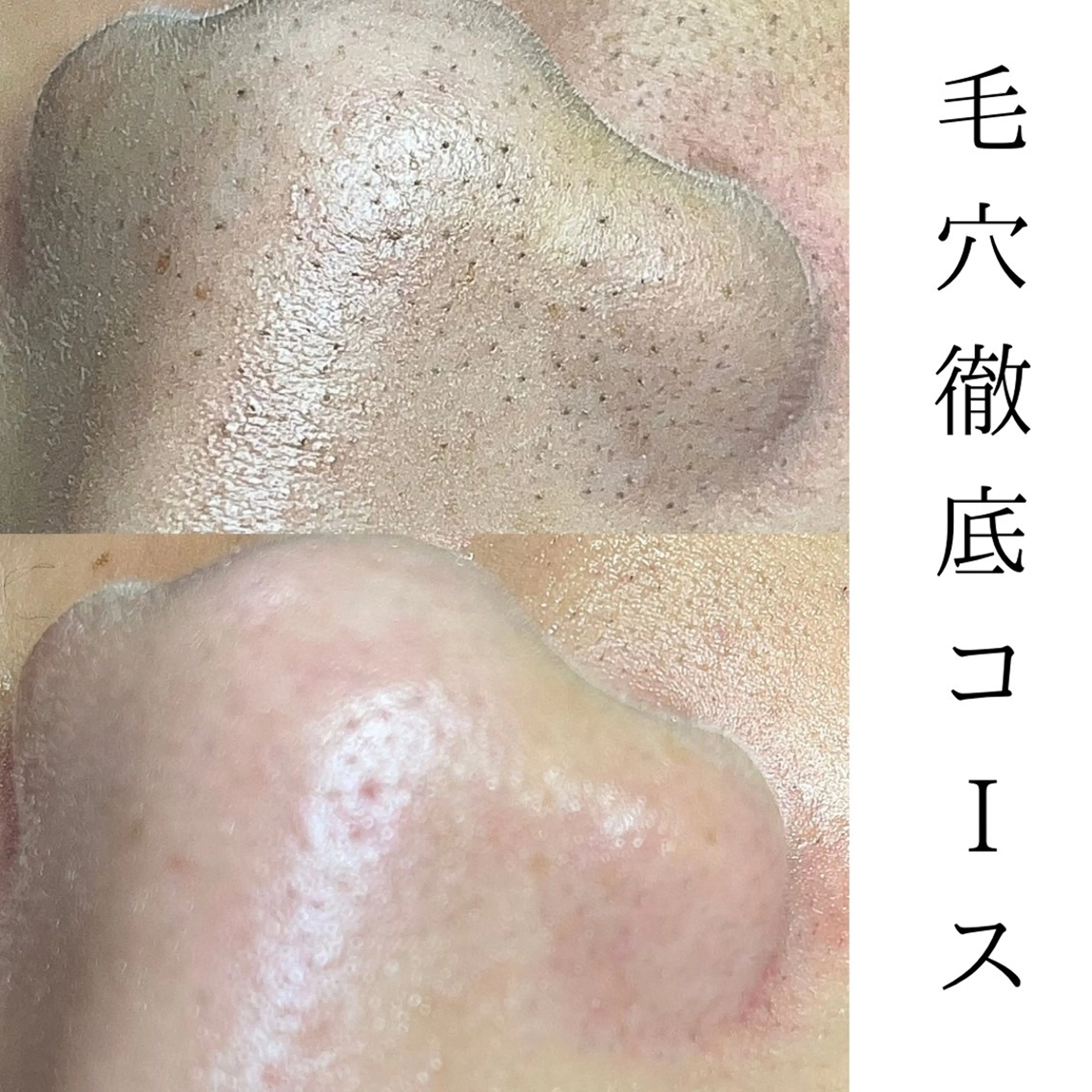 private salon OUKA所属・OUKA脱毛 毛穴ケアフェイシャルのエステ・リラクイメージ