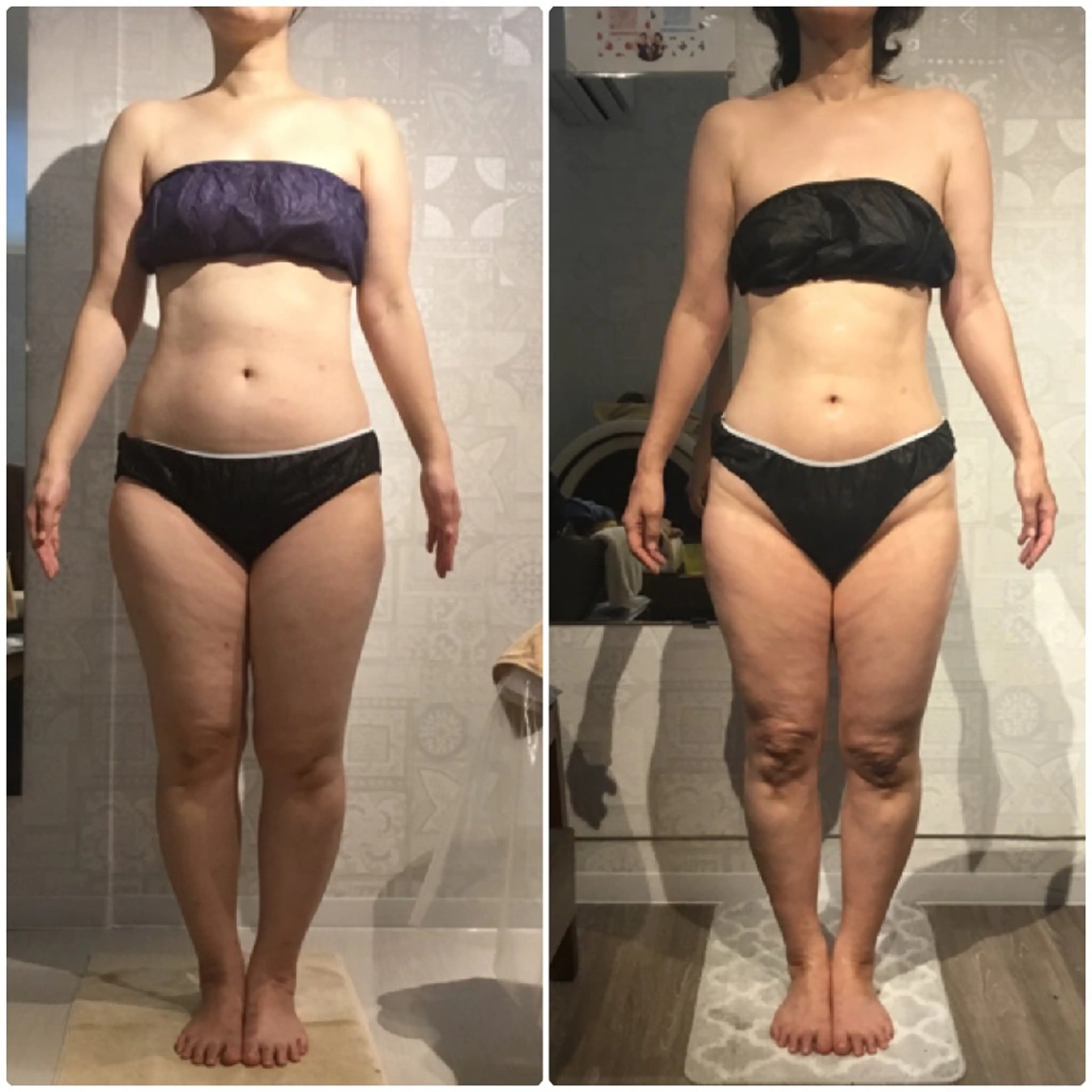 エステ 痩身・フェイシャル エステサンテボーテのエステ・リラクイメージ