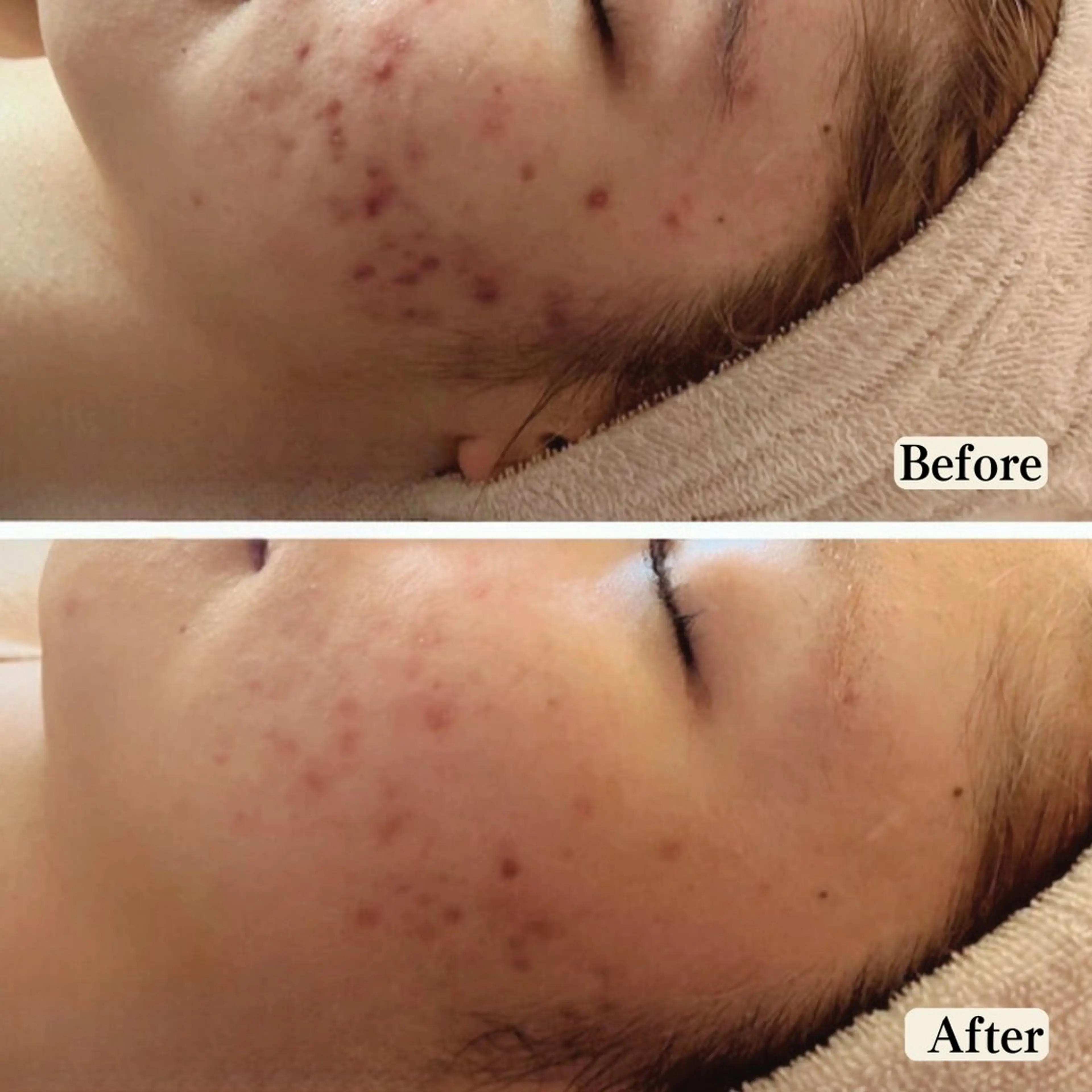 エステ UILANI所属・UI LANIのエステ・リラクイメージ