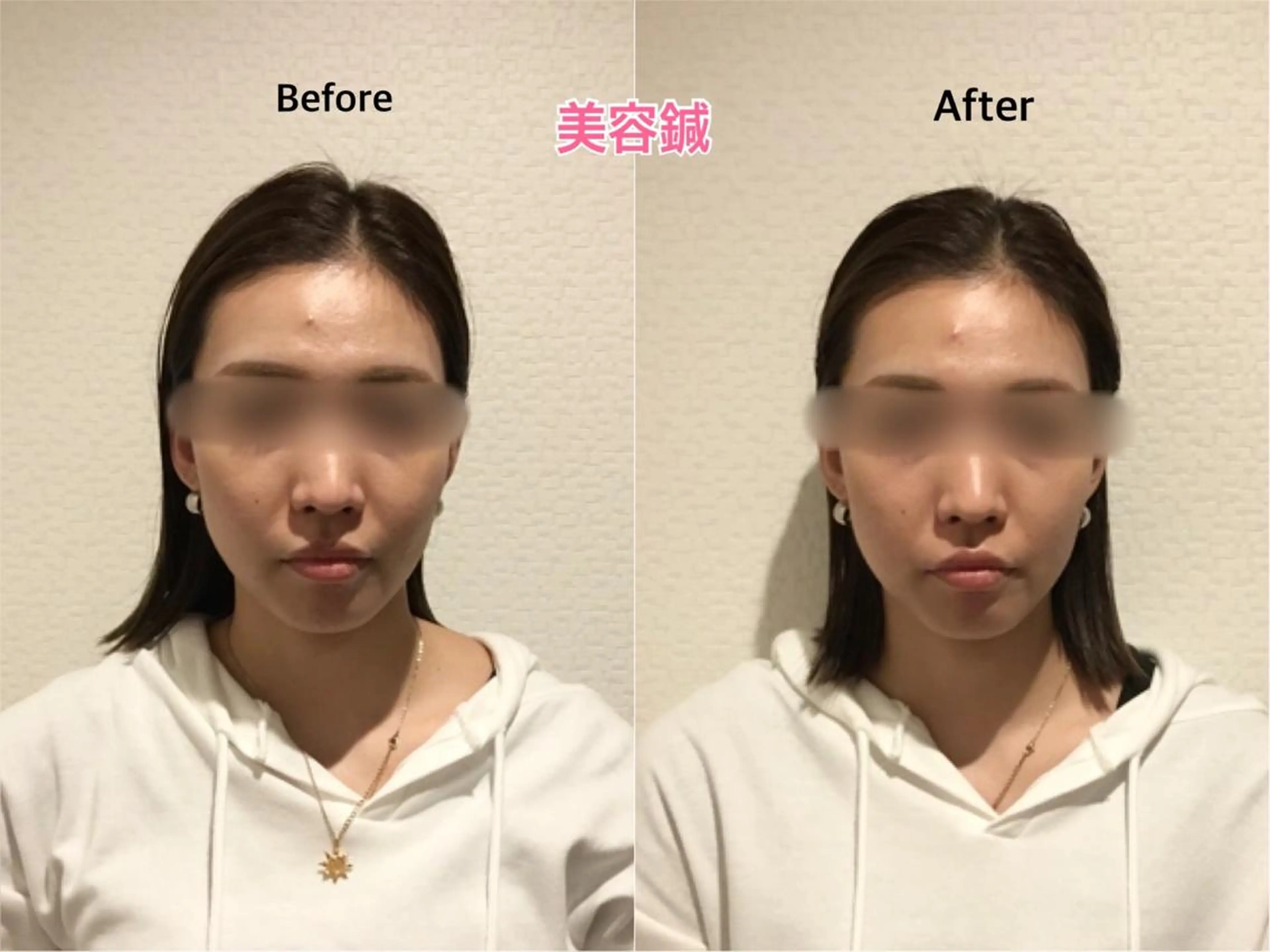 エステ チキバン美容鍼灸整体 サロン心斎橋店のエステ・リラクイメージ