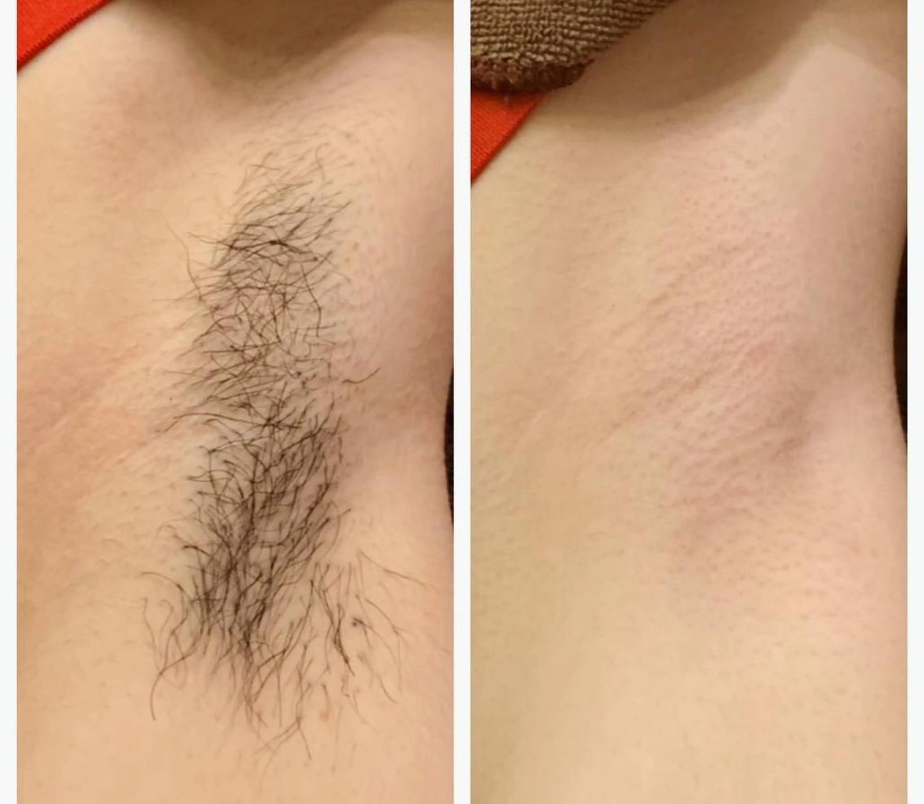 ラヴァコケット 梅田店のエステ・リラクイメージ