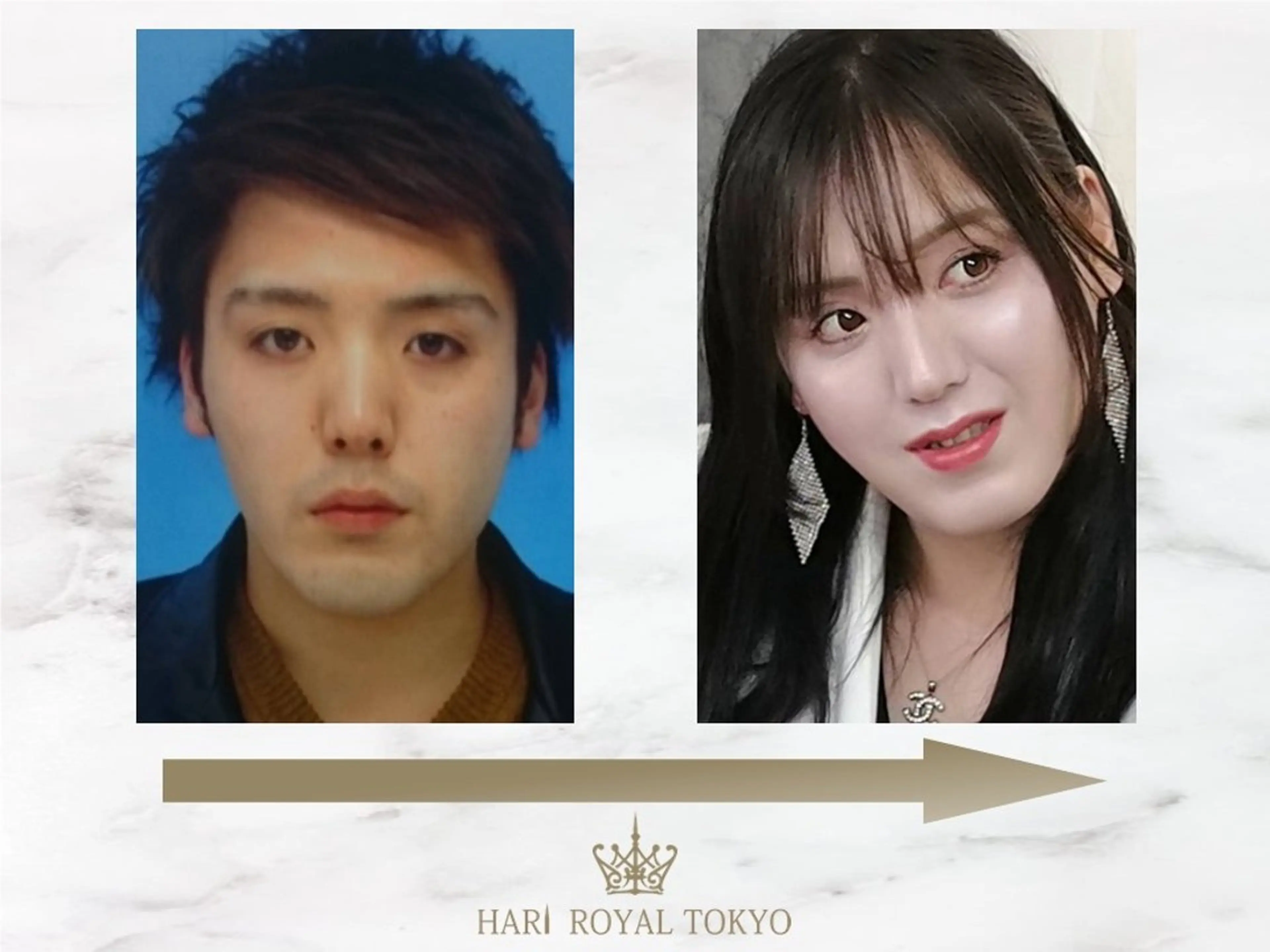 エステ ハリロイヤルトーキョー武蔵小山所属・ニューハーフ鍼灸師 🖤🤍Saya🌹のエステ・リラクイメージ