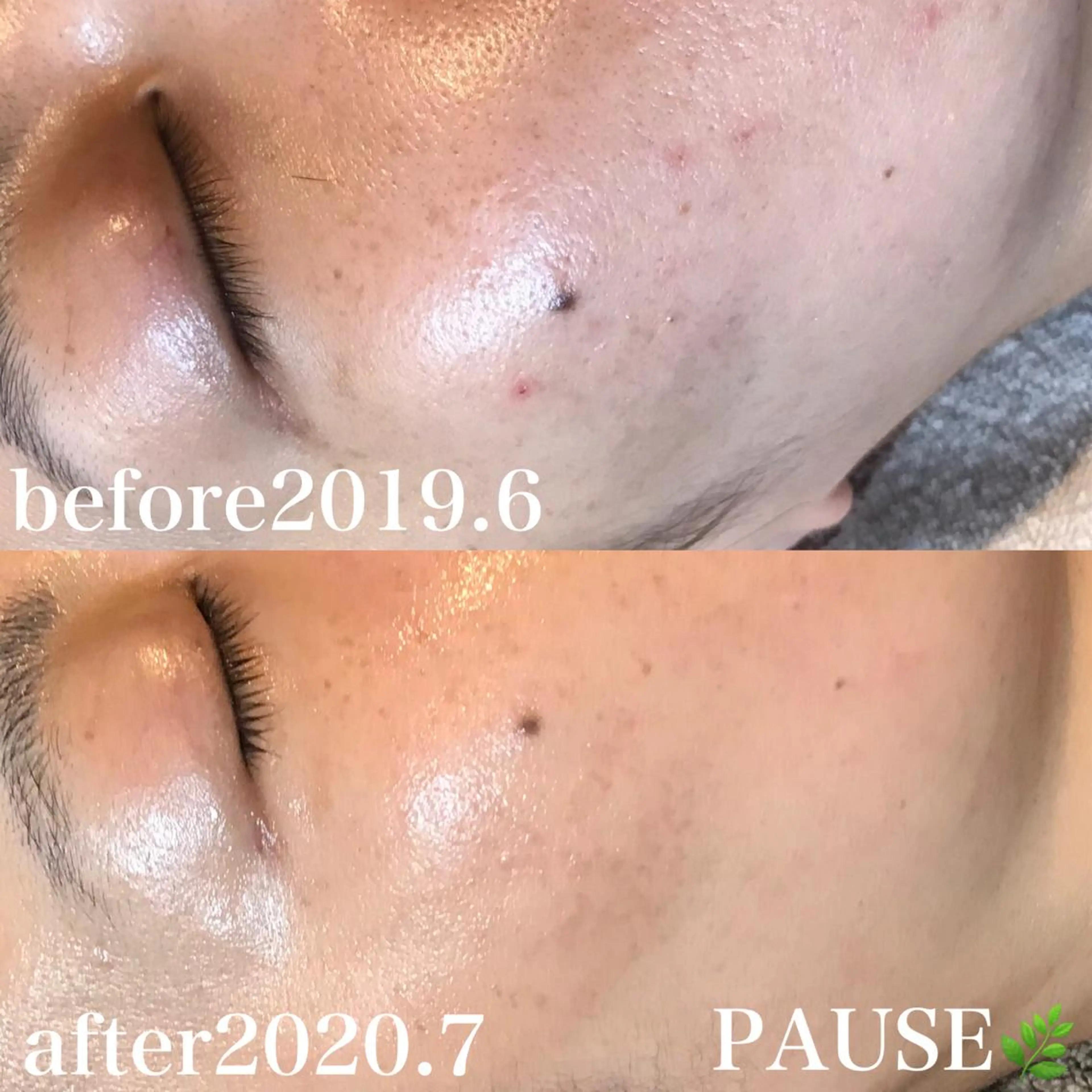 エステ 浜野 恵美のエステ・リラクイメージ