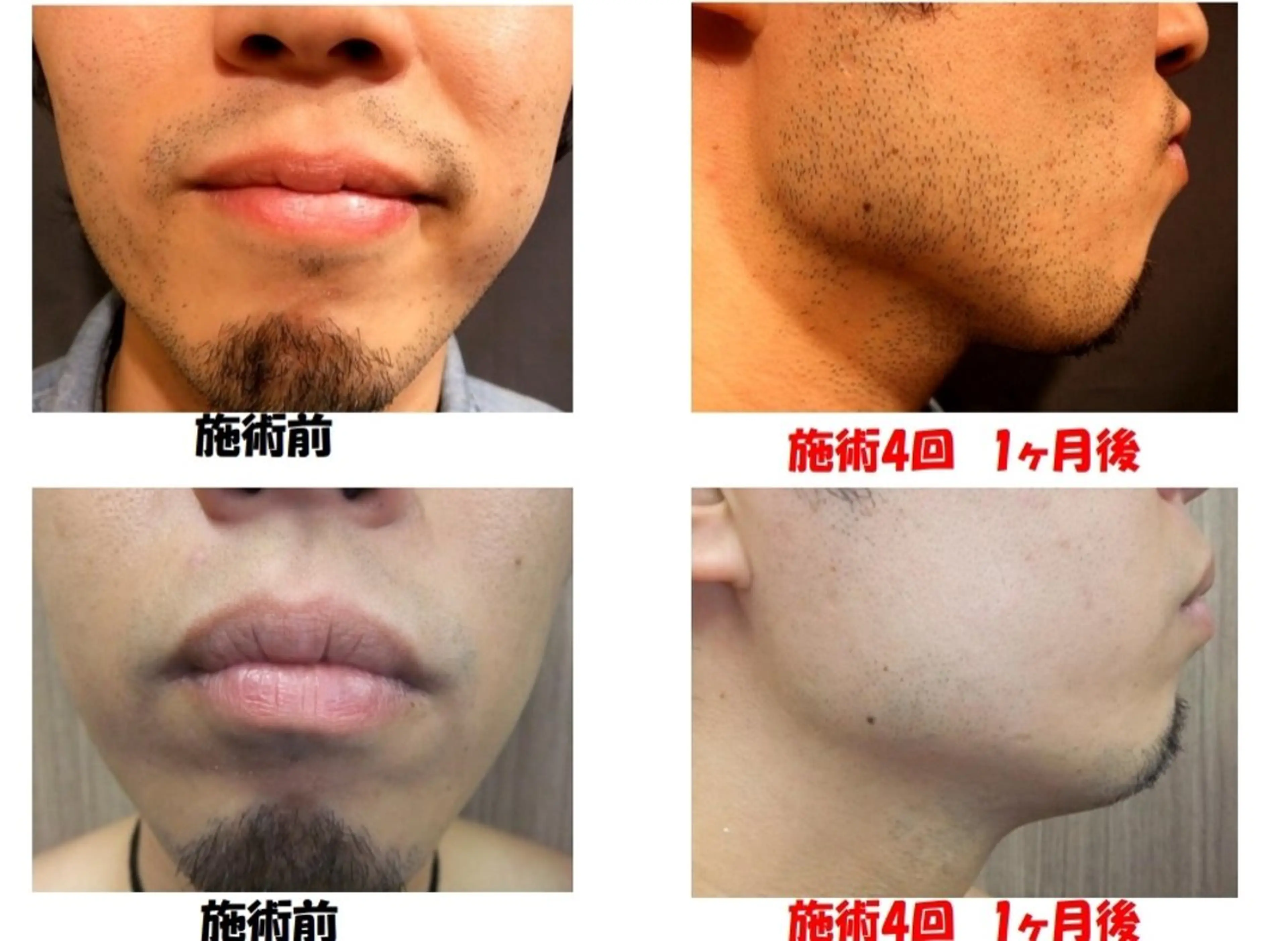 Salon Ree Belle(サロン リベル)所属・サロン リベル YUKAのエステ・リラクイメージ