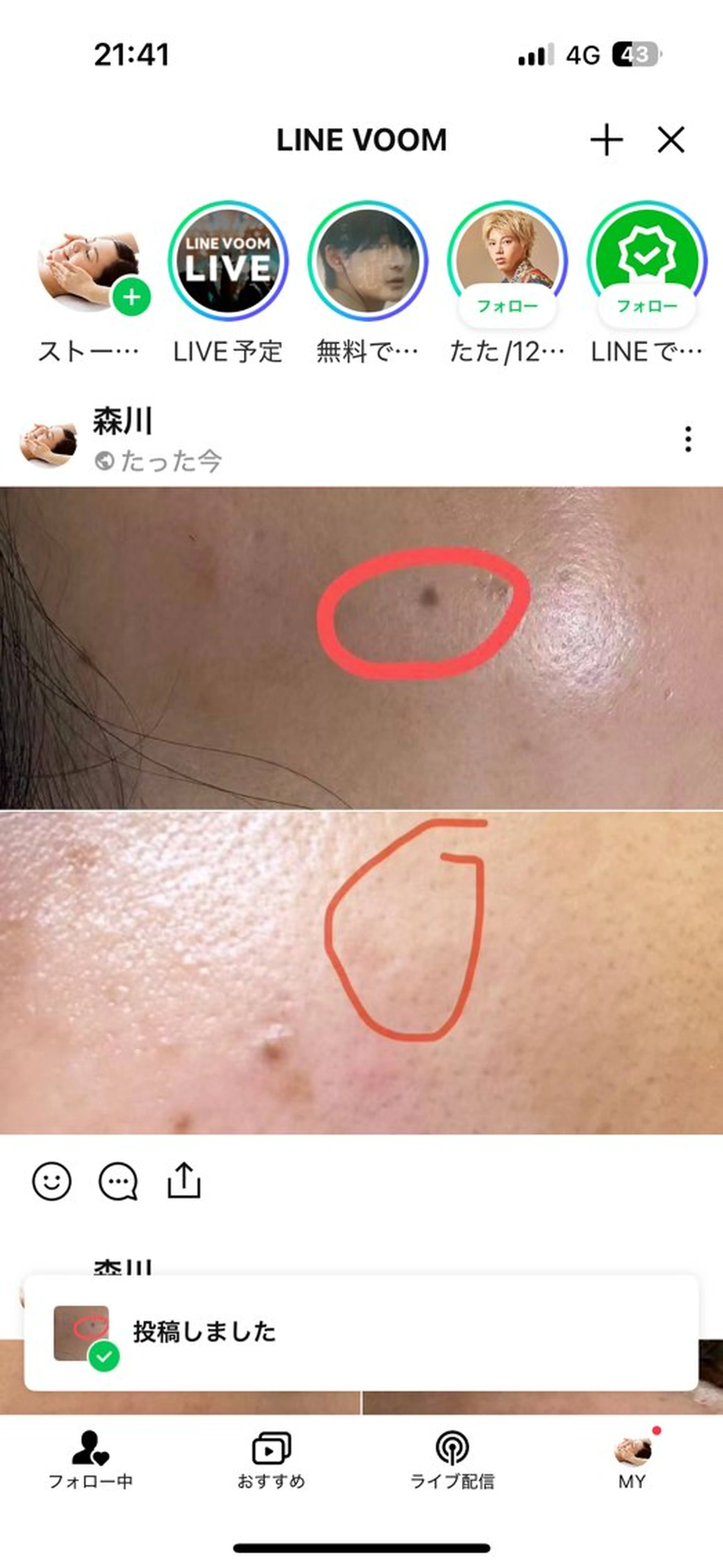 エステ エステサロン藍月所属・森川 藍月のエステ・リラクイメージ