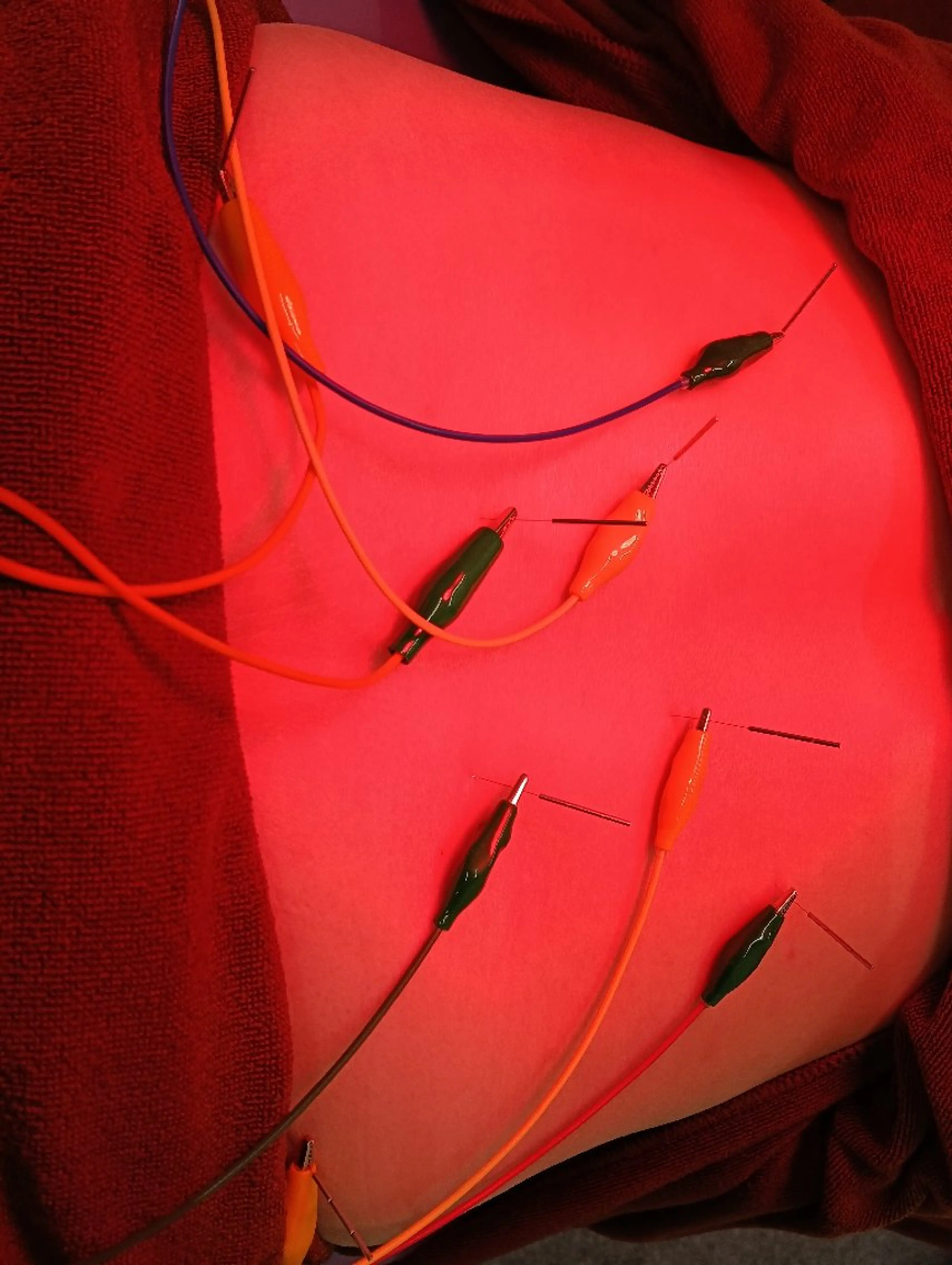 楽楽鍼灸院・整骨院所属・楽楽鍼灸院・整骨院 澤田　直輝のその他イメージ