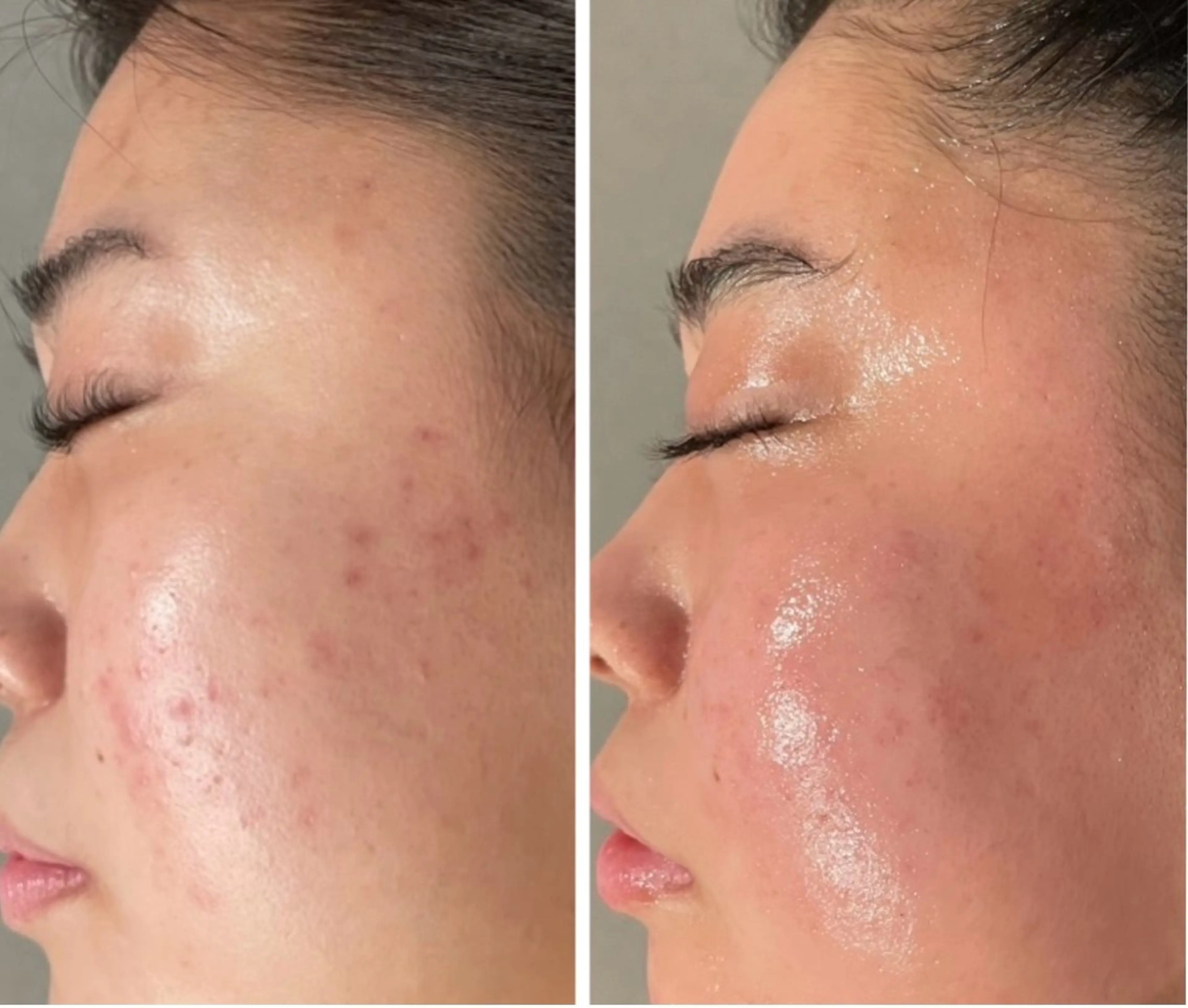 エステ エステ／ネイル/脱毛 R.Msalonのネイルデザイン