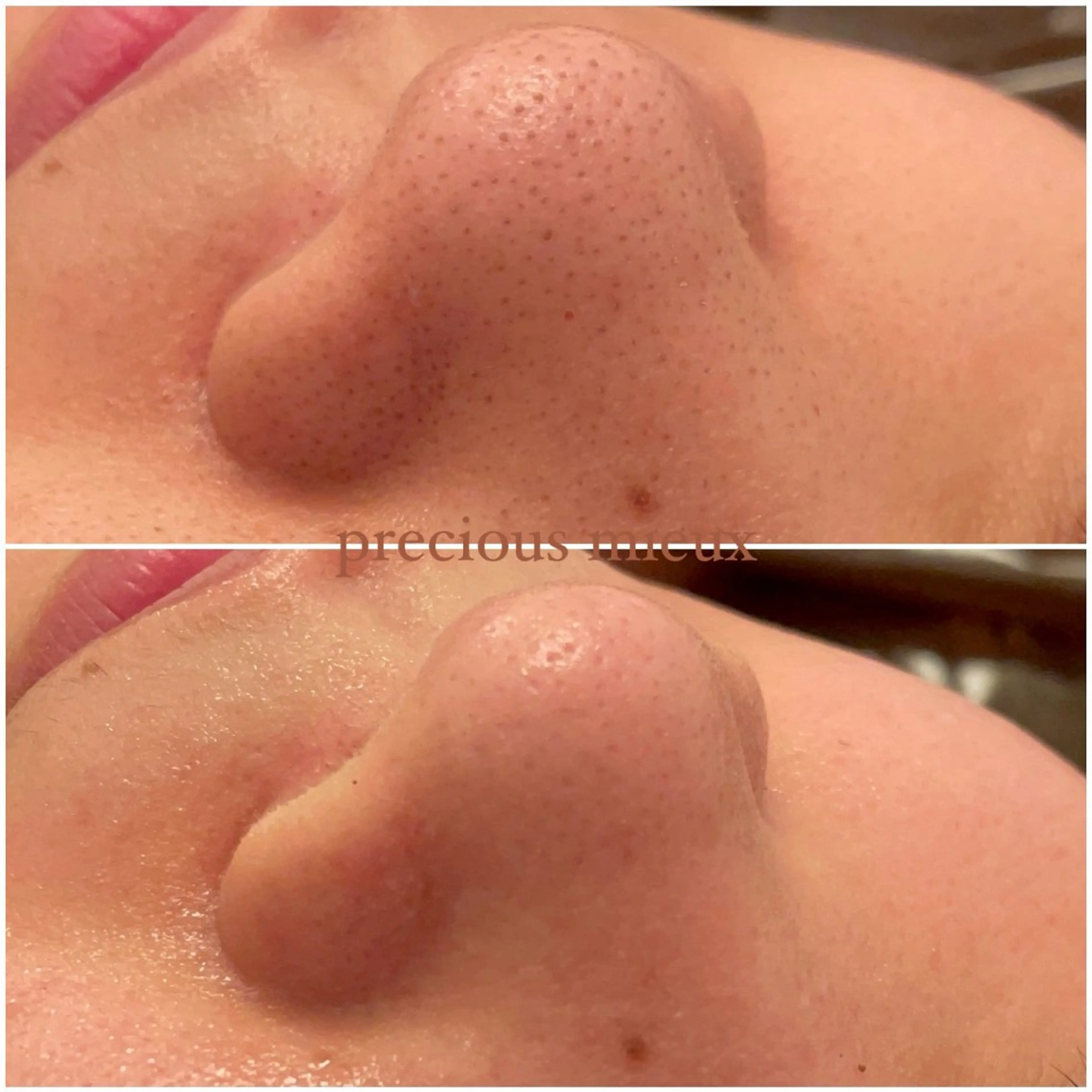 【スペシャル毛穴洗浄🧼】数々の毛穴洗浄を試して1番☝️良かったメーカーさんのものを使用🤩✨毛穴の大掃除メニュー‼️の写真