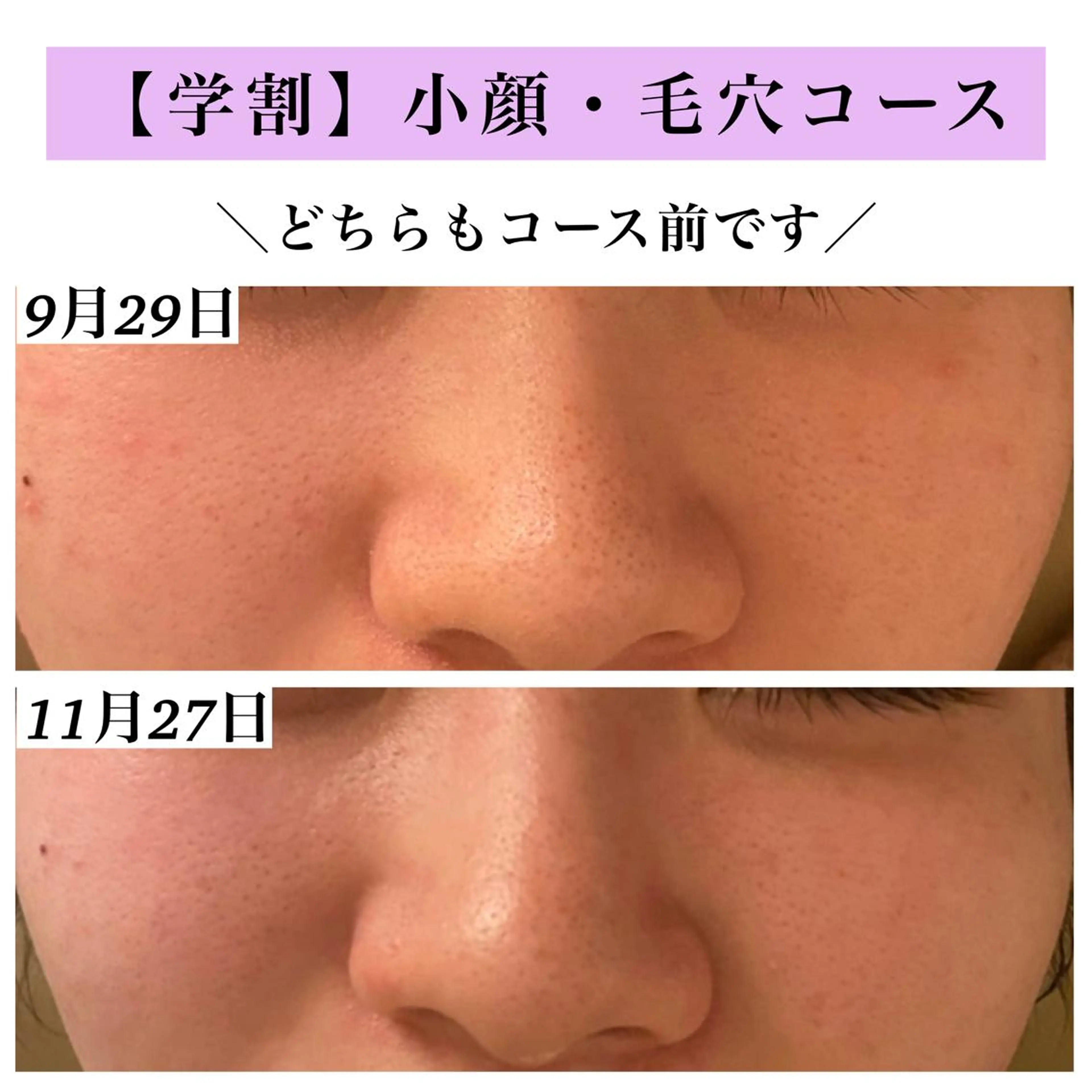 Bellesthe （ベルエステ）のエステ・リラクイメージ