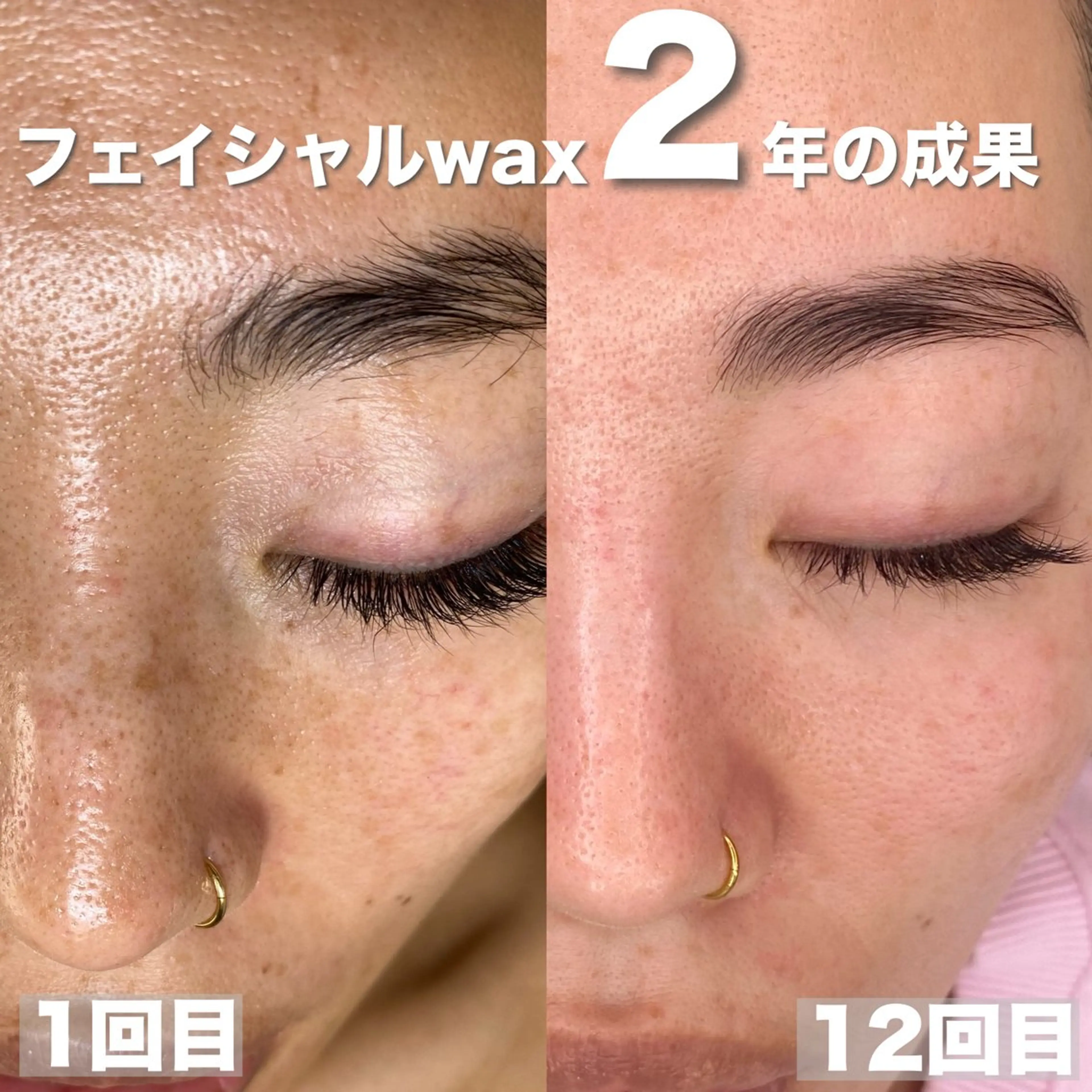 脱毛 mone~total care salon~所属・mone (モーネ)のマツエク・マツパデザイン