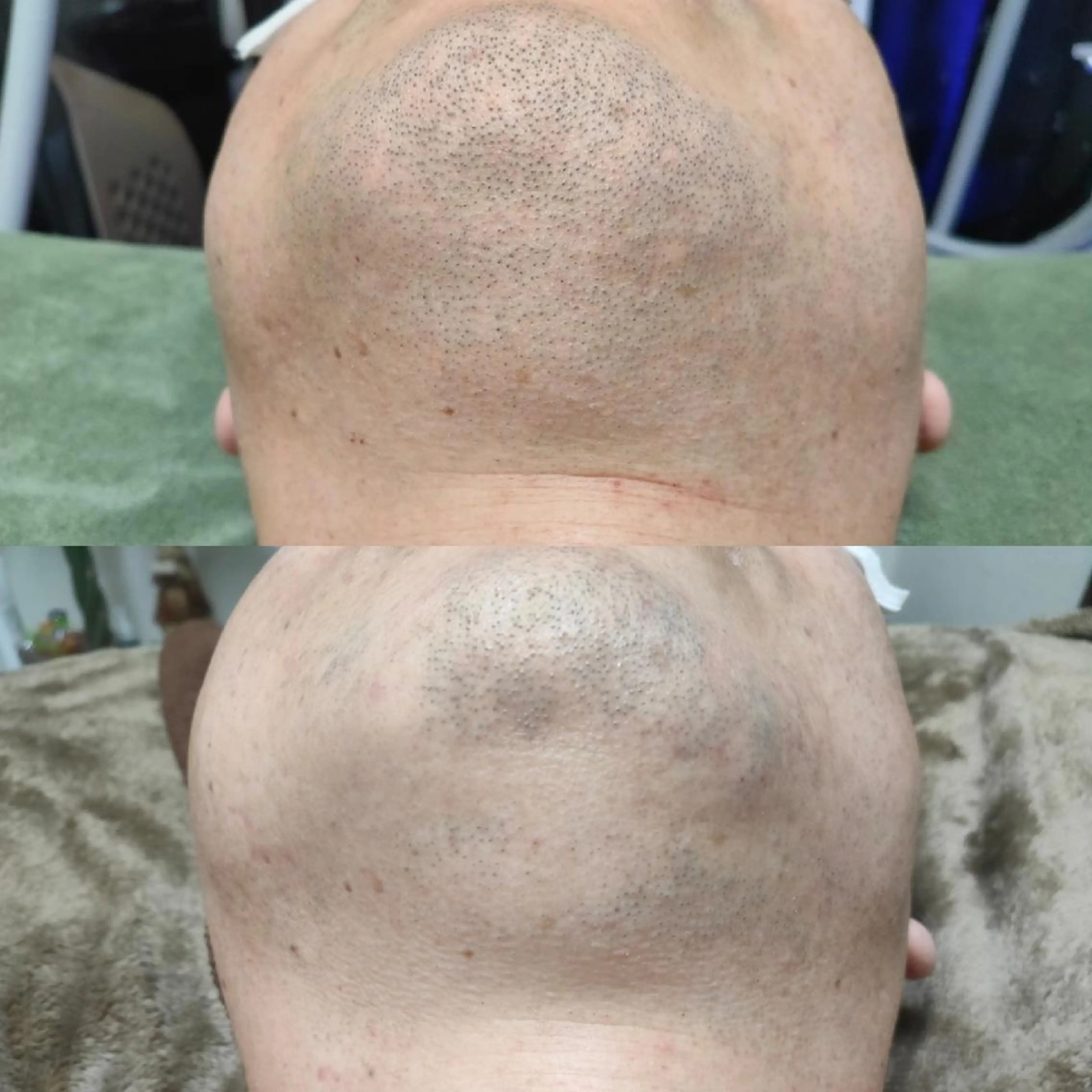 メンズ 武 藤のエステ・リラクイメージ