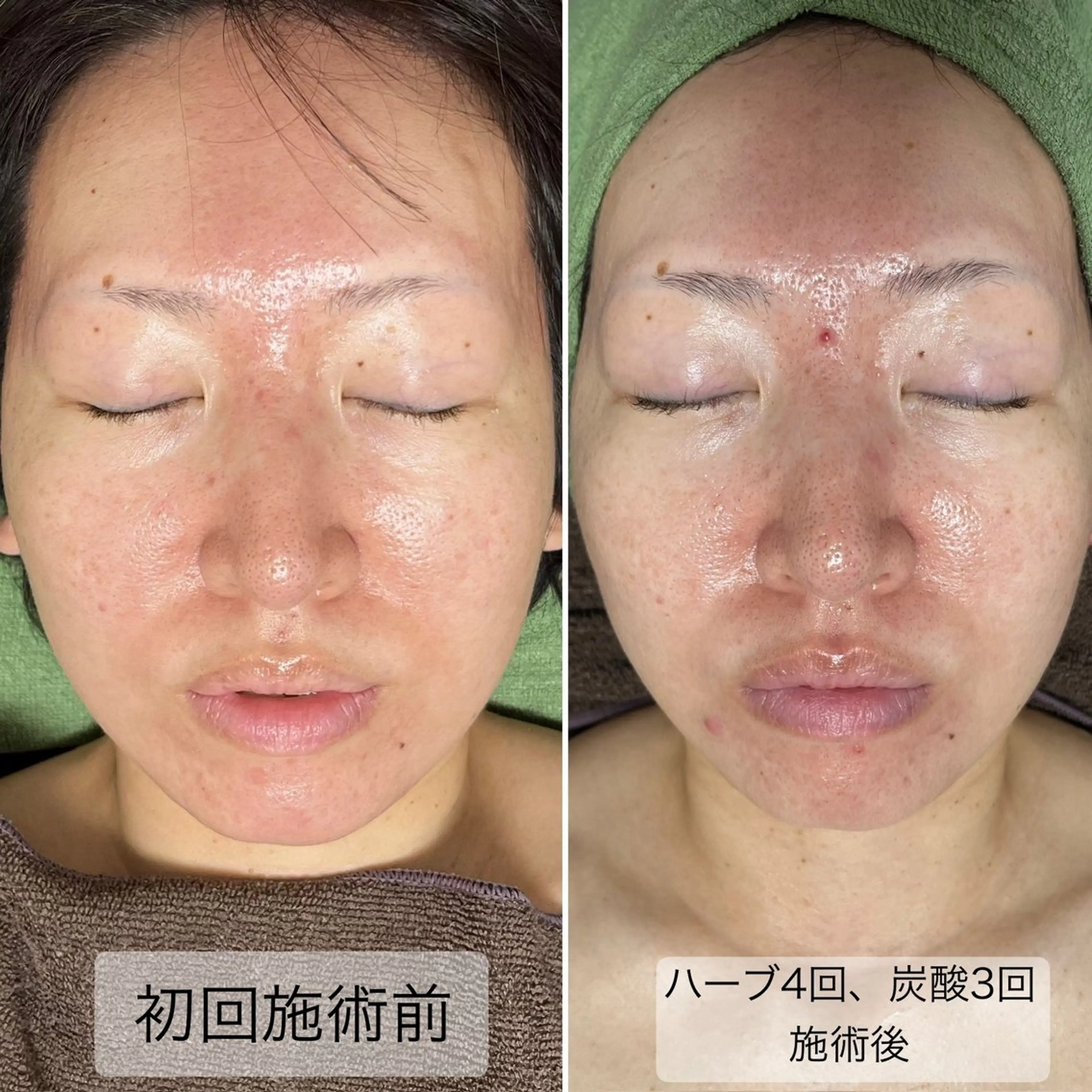 エステ SlowGarden 体質肌質改善サロンのヘアスタイル