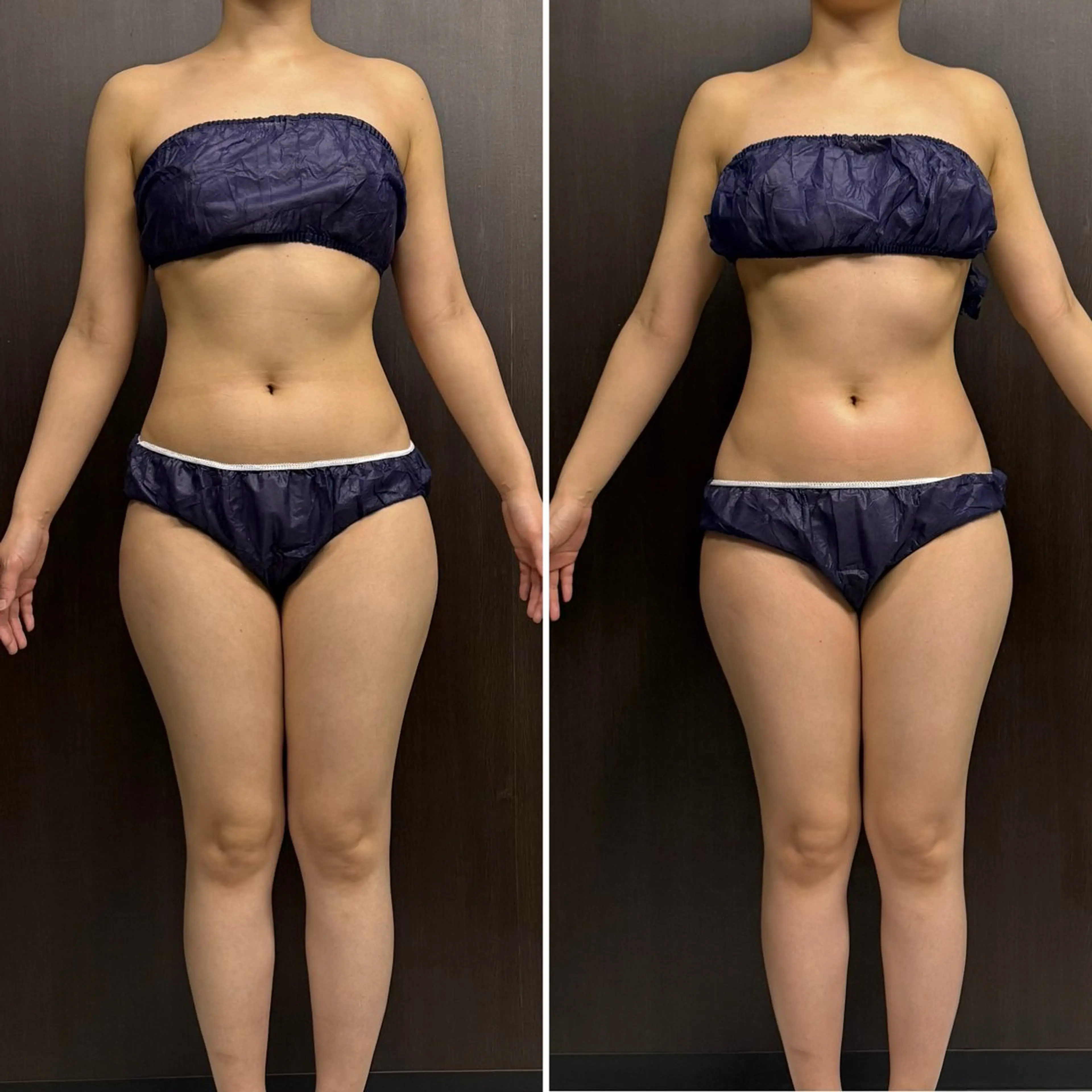 赤澤/本気痩せ・脱毛 ・ノーファンデ肌のエステ・リラクイメージ