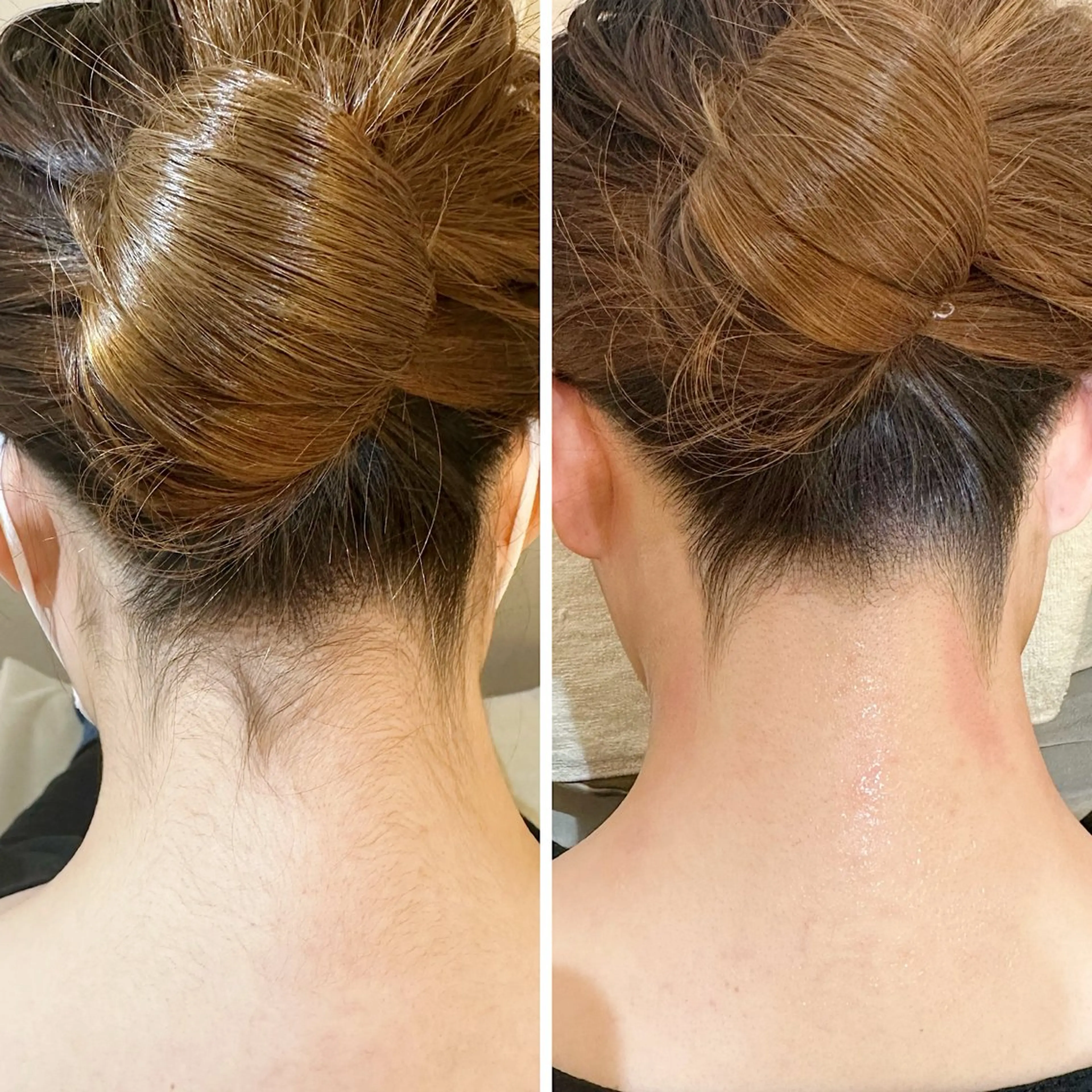 脱毛 うなじ脱毛/美肌脱毛 LABELのエステ・リラクイメージ