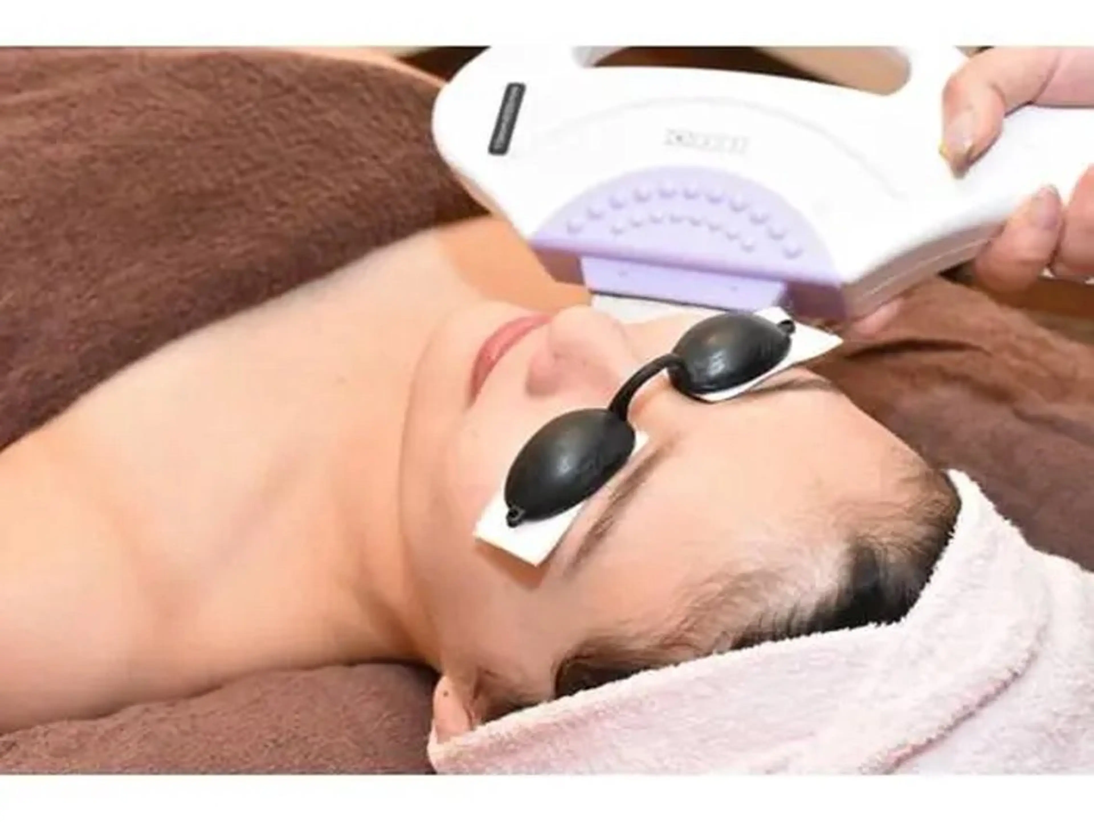 【女性限定】コラーゲン美肌顔脱毛¥5000→¥1500の写真