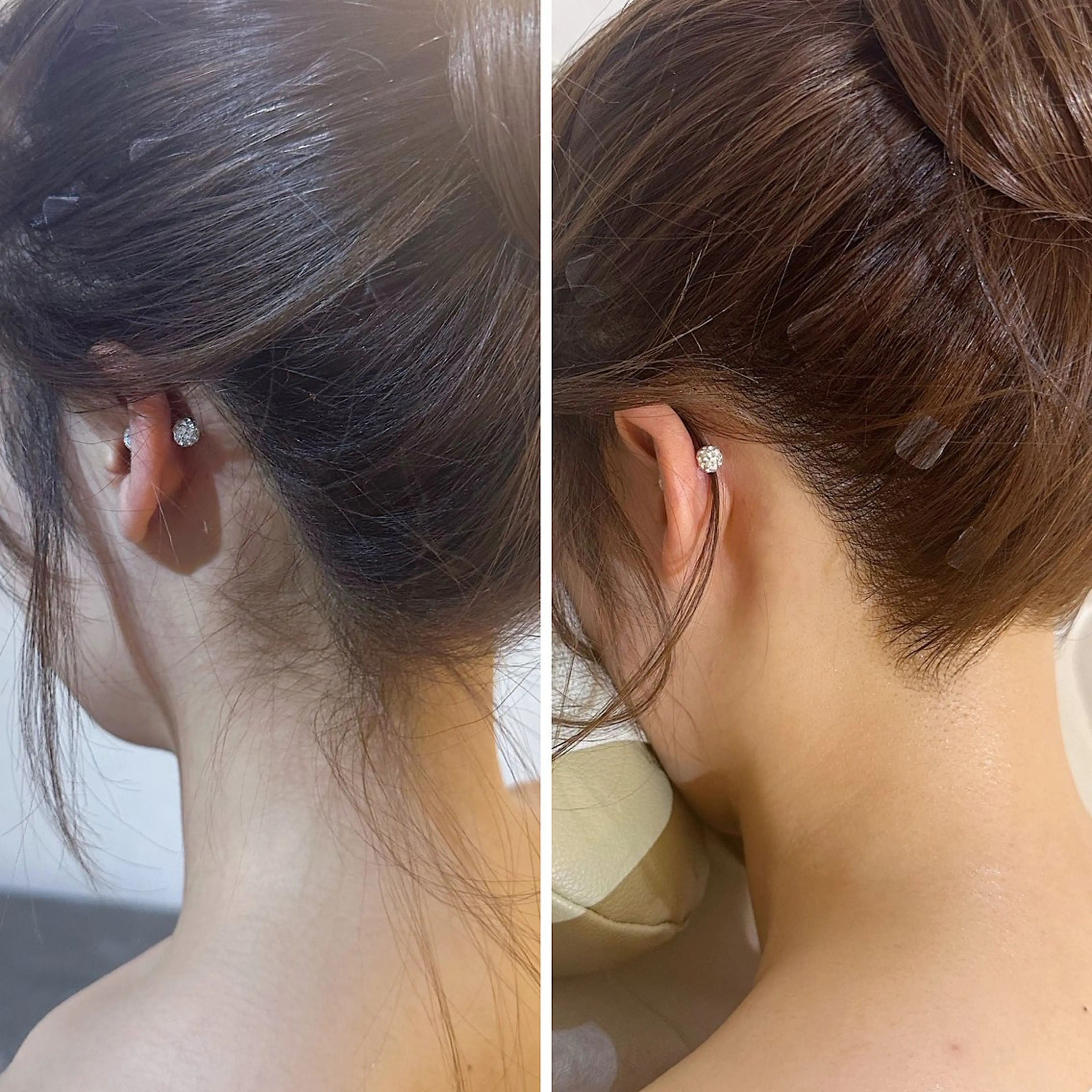 脱毛 うなじ脱毛/美肌脱毛 LABELのエステ・リラクイメージ