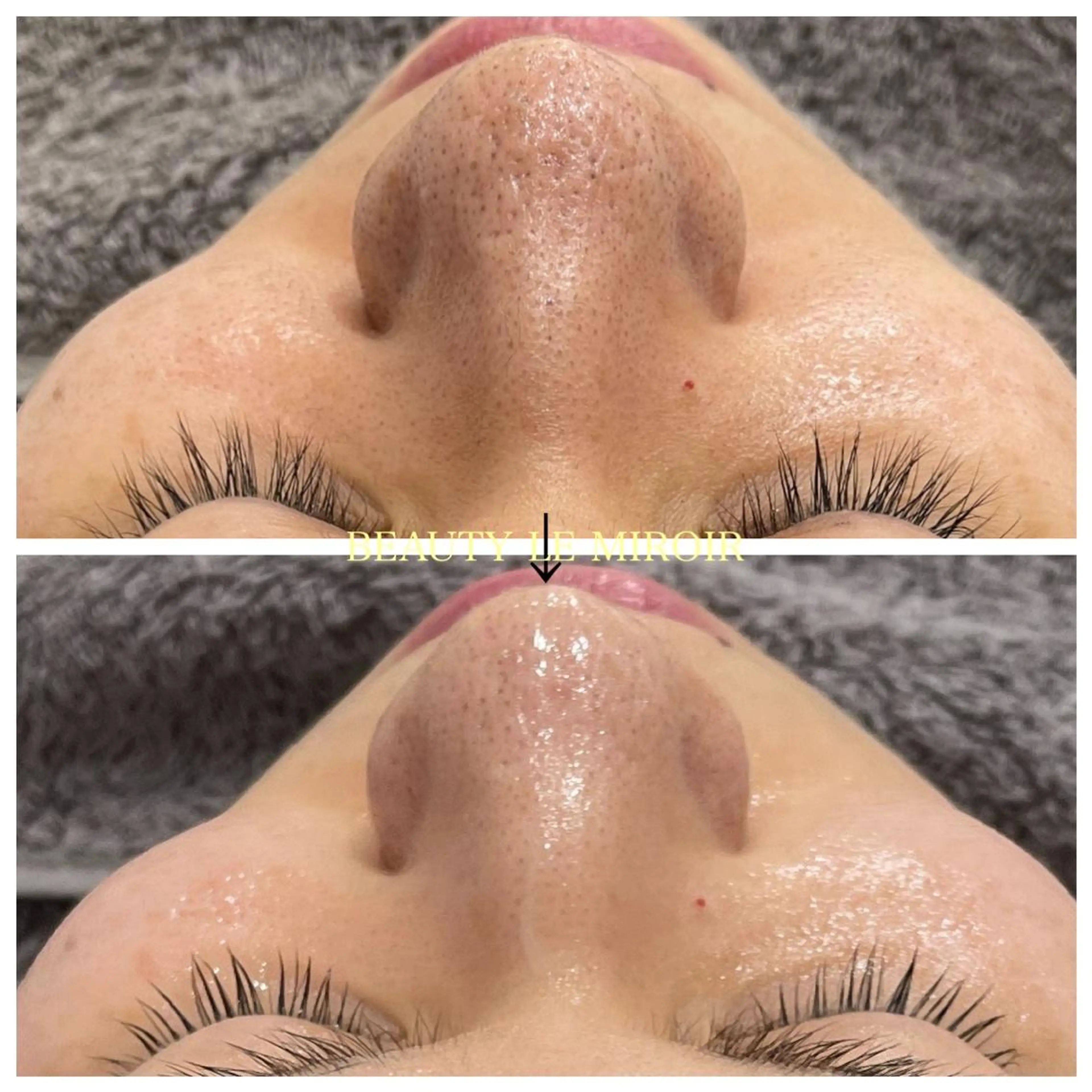 マツエク・マツパ ビューティー ミロワールのエステ・リラクイメージ