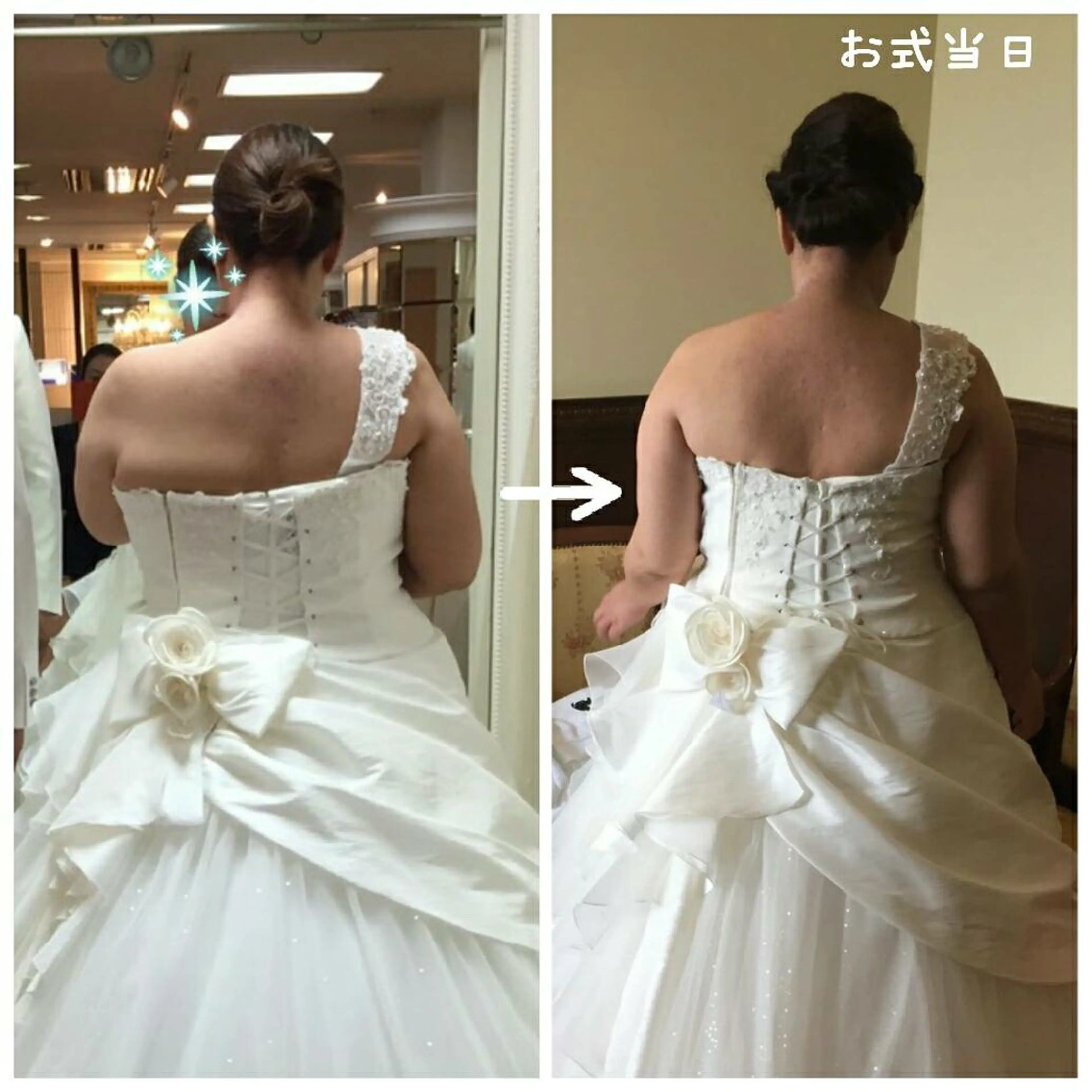 💐花嫁様🎉【背中ブライダルエステ(人気No.1背中クレンジング＆クレイパック付)】＆無料相談コースの写真