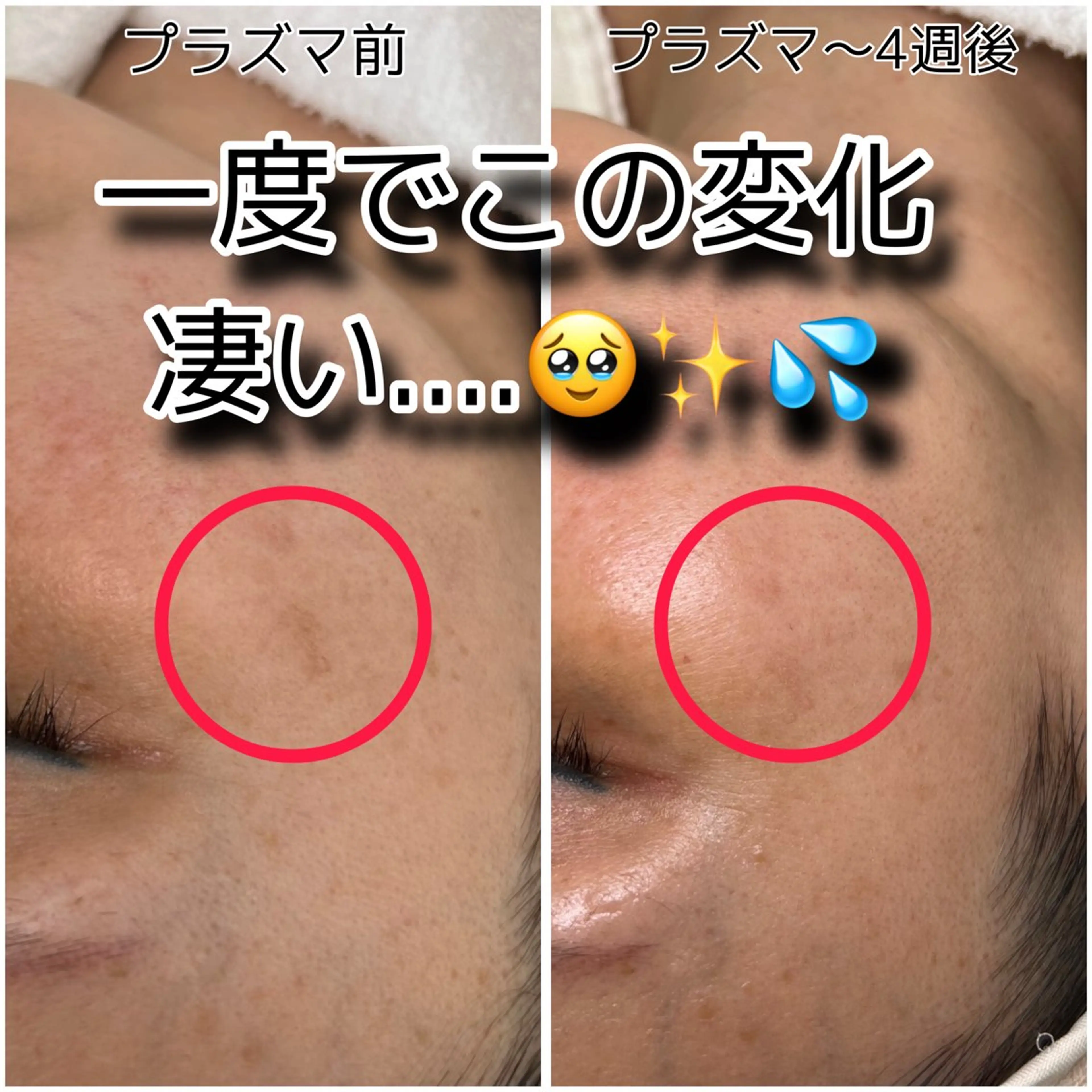 SHECIAお顔剃りシェービング専門店所属・お顔剃りエステサロン SHECIAのその他イメージ