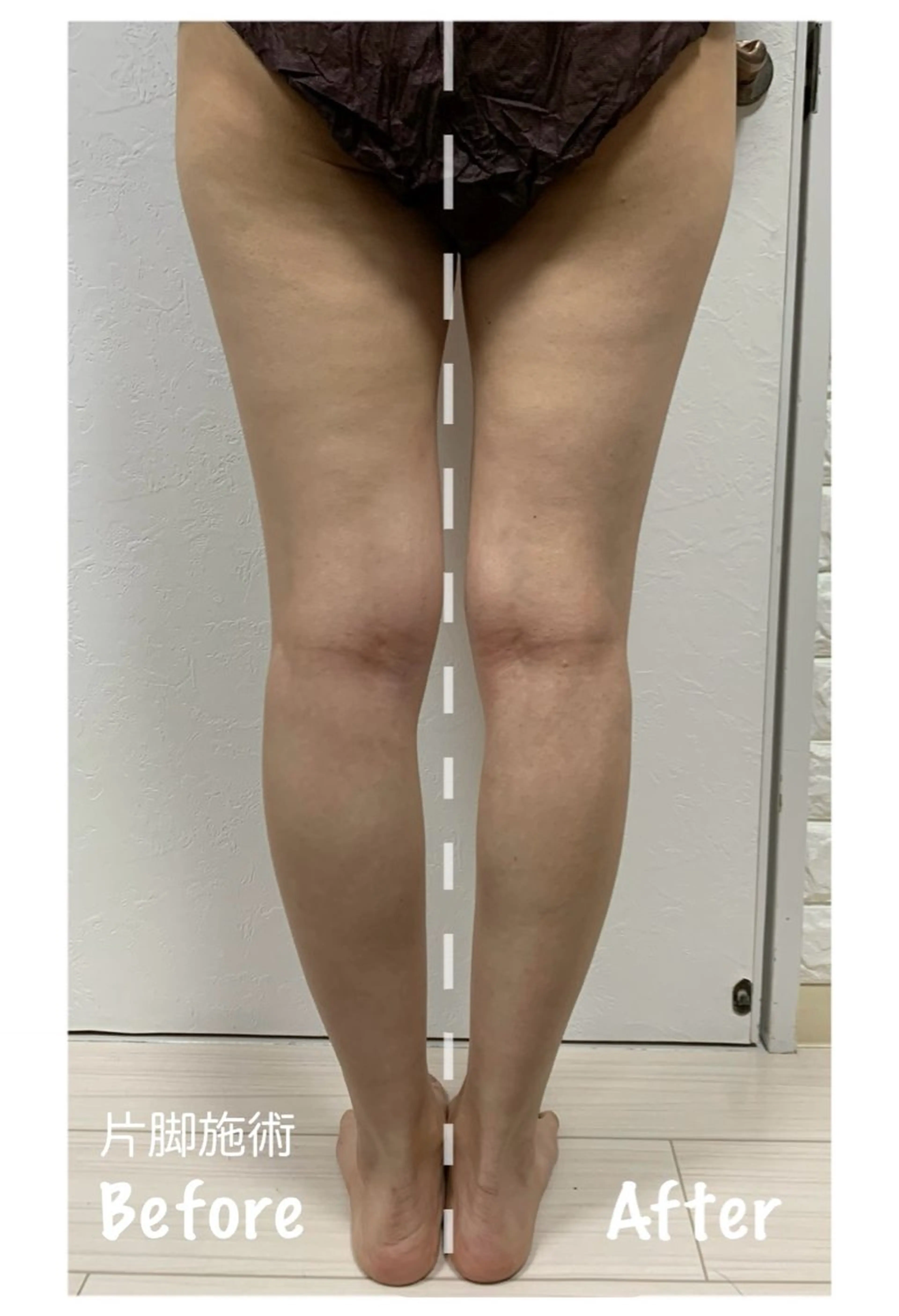 エステ リラク KalanDiva〜 ｶﾗﾝﾃﾞｨｰﾊﾞ〜のエステ・リラクイメージ