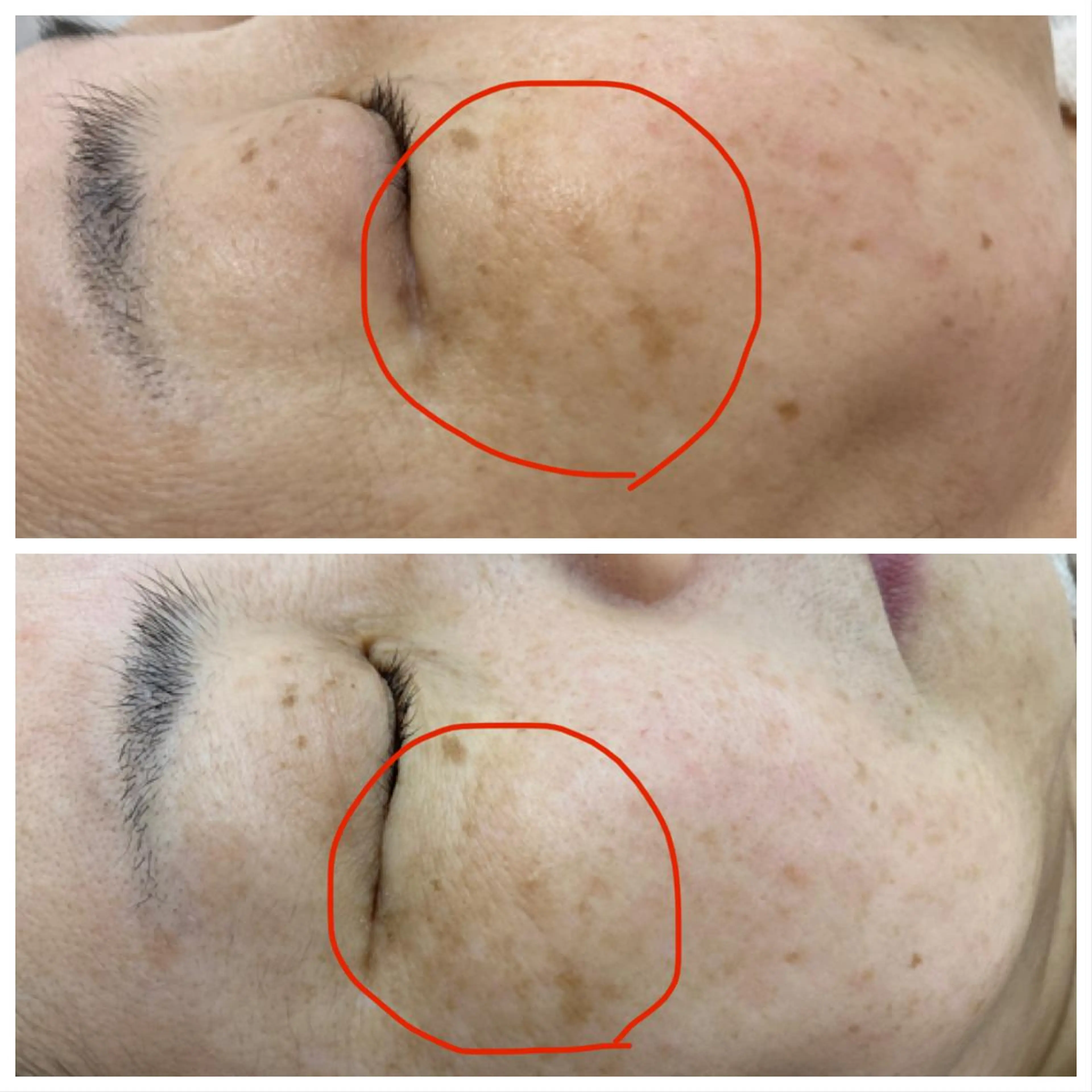 CEサロンblanc bebe所属・高村 有紀のエステ・リラクイメージ