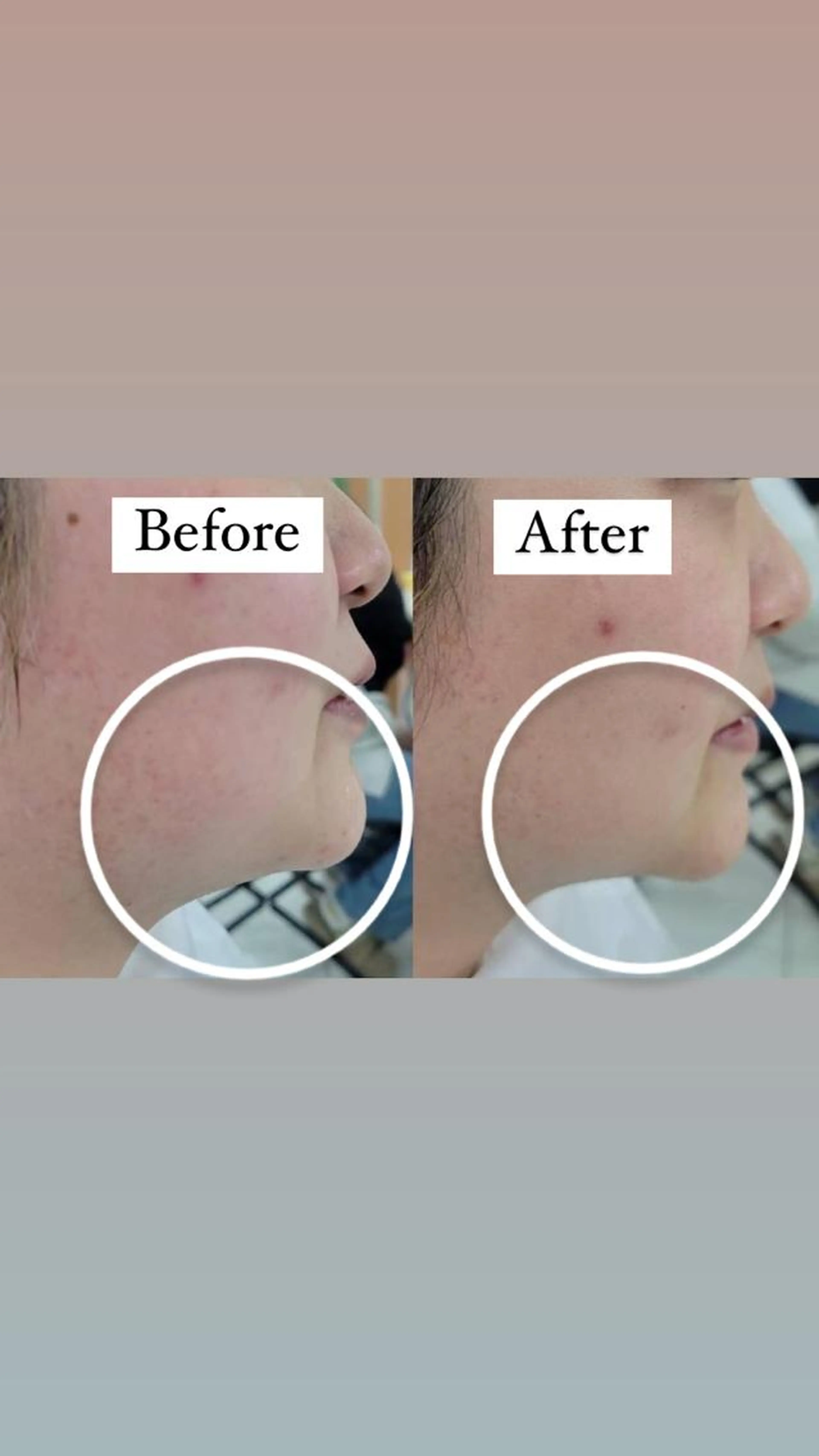 新社会人様限定メニューになっております⭐️1カ月の集中お肌ケアモニターの写真