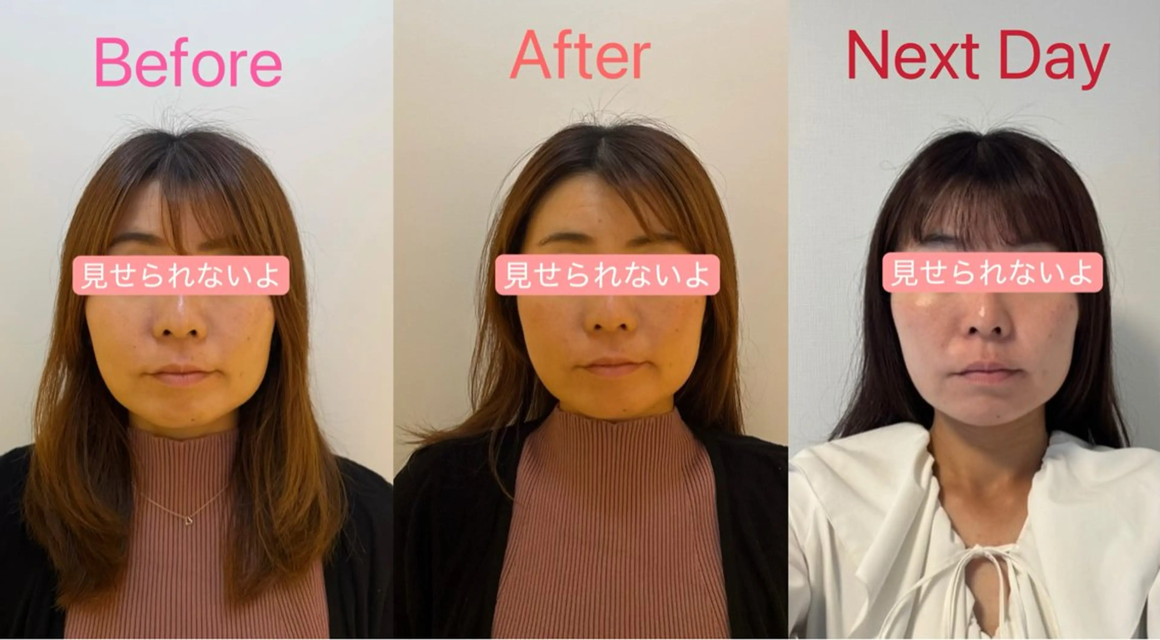 エステ リラク サロン・ドゥ・レキューム所属・小顔整体専門✨ Satomiのエステ・リラクイメージ