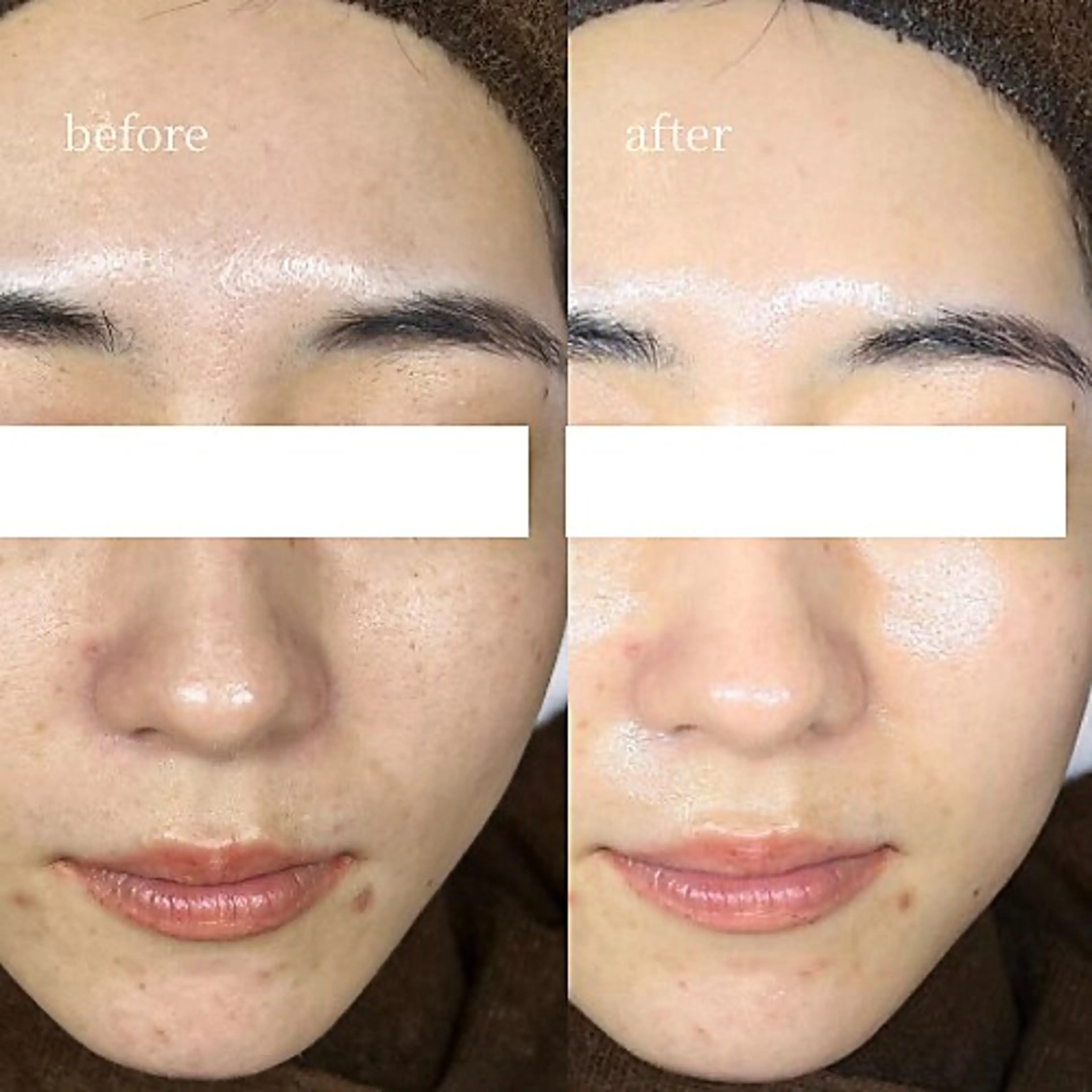 エステ 韓国肌管理・肌質改善 EARNEST心斎橋のエステ・リラクイメージ